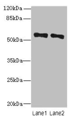 Western blot. All lanes: ZNF689 antibody at 5µg/ml. Lane 1: Hela whole cell lysate. Lane 2: HepG2 whole cell lysate. Secondary. Goat polyclonal to rabbit IgG at 1/10000 dilution. Predicted band size: 57 kDa. Observed band size: 57 kDa