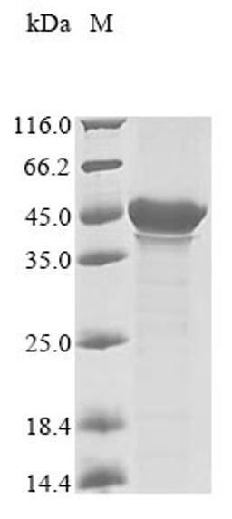 (Tris-Glycine gel) Discontinuous SDS-PAGE (reduced) with 5% enrichment gel and 15% separation gel.