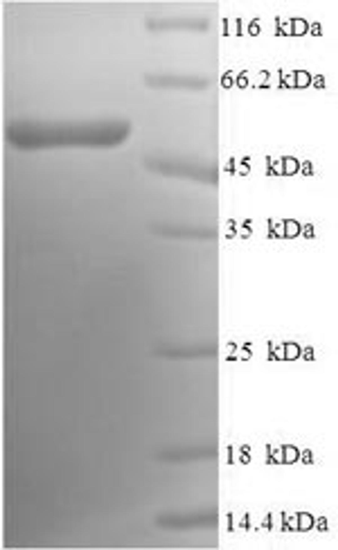 (Tris-Glycine gel) Discontinuous SDS-PAGE (reduced) with 5% enrichment gel and 15% separation gel.
