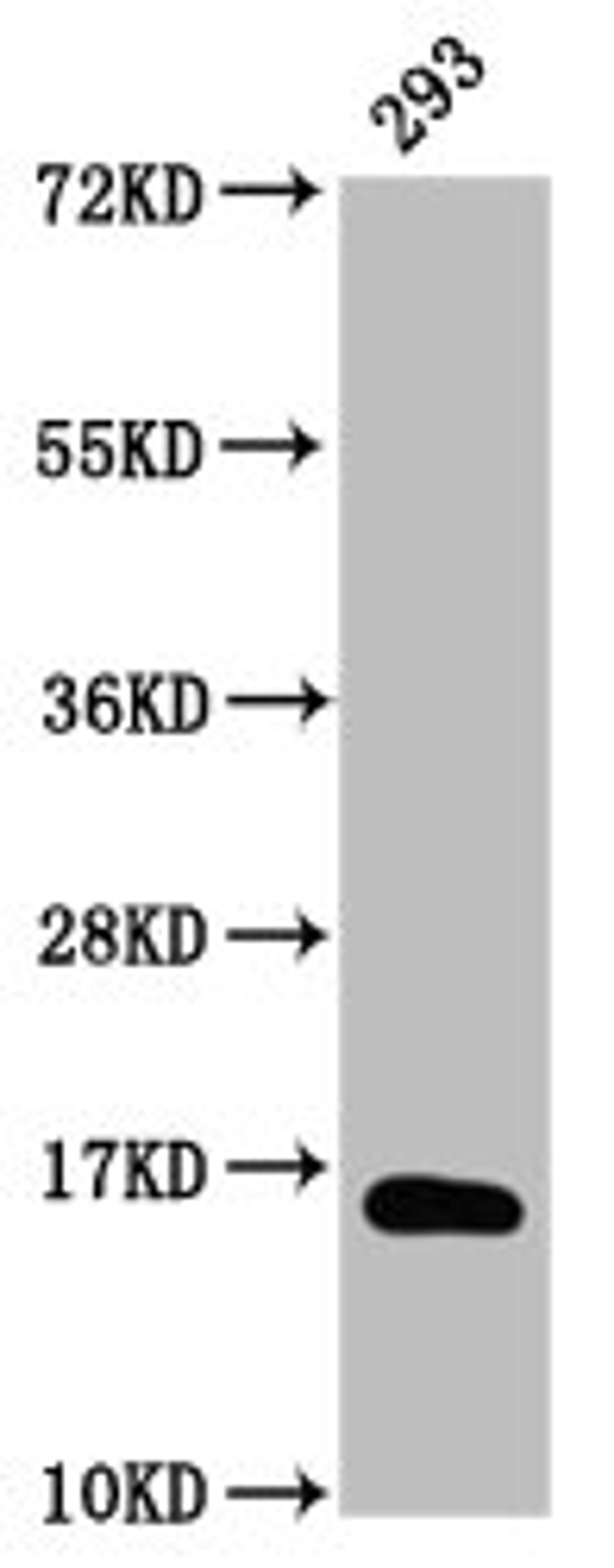 Western Blot. Positive WB detected in: 293 whole cell lysate (treated with 30mM sodium butyrate for 4h) . All lanes: HIST1H3A antibody at 1µg/ml. Secondary. Goat polyclonal to rabbit IgG at 1/50000 dilution. Predicted band size: 16 kDa. Observed band size: 16 kDa
