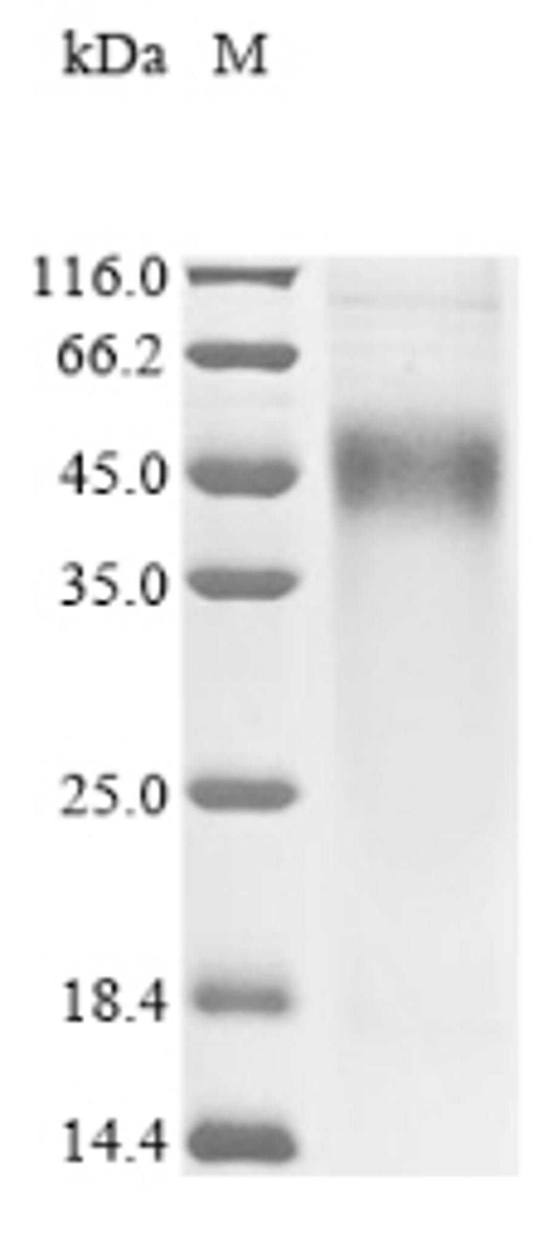 (Tris-Glycine gel) Discontinuous SDS-PAGE (reduced) with 5% enrichment gel and 15% separation gel.
