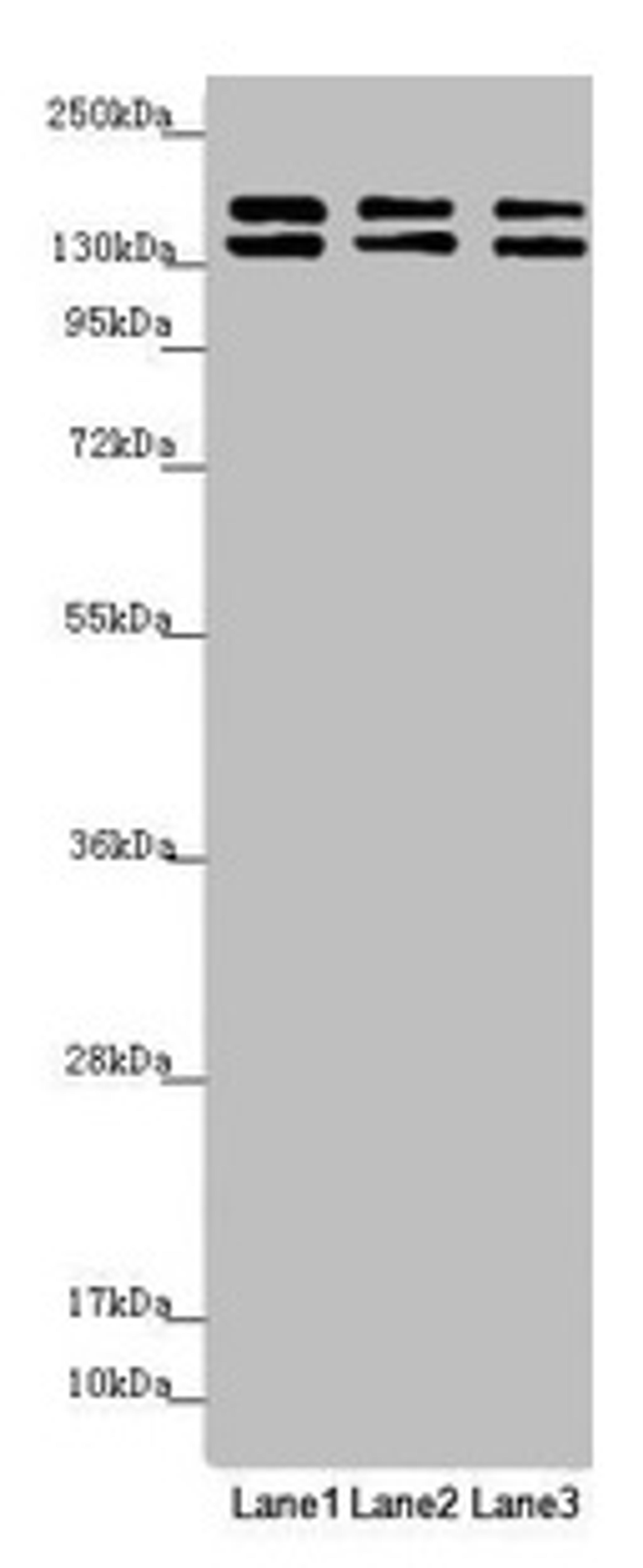 Western blot. All lanes: UACA antibody at 5.51µg/ml. Lane 1: Hela whole cell lysate. Lane 2: A549 whole cell lysate. Lane 3: Jurkat whole cell lysate. Secondary. Goat polyclonal to rabbit IgG at 1/10000 dilution. Predicted band size: 163, 162 kDa. Observed band size: 163, 140 kDa