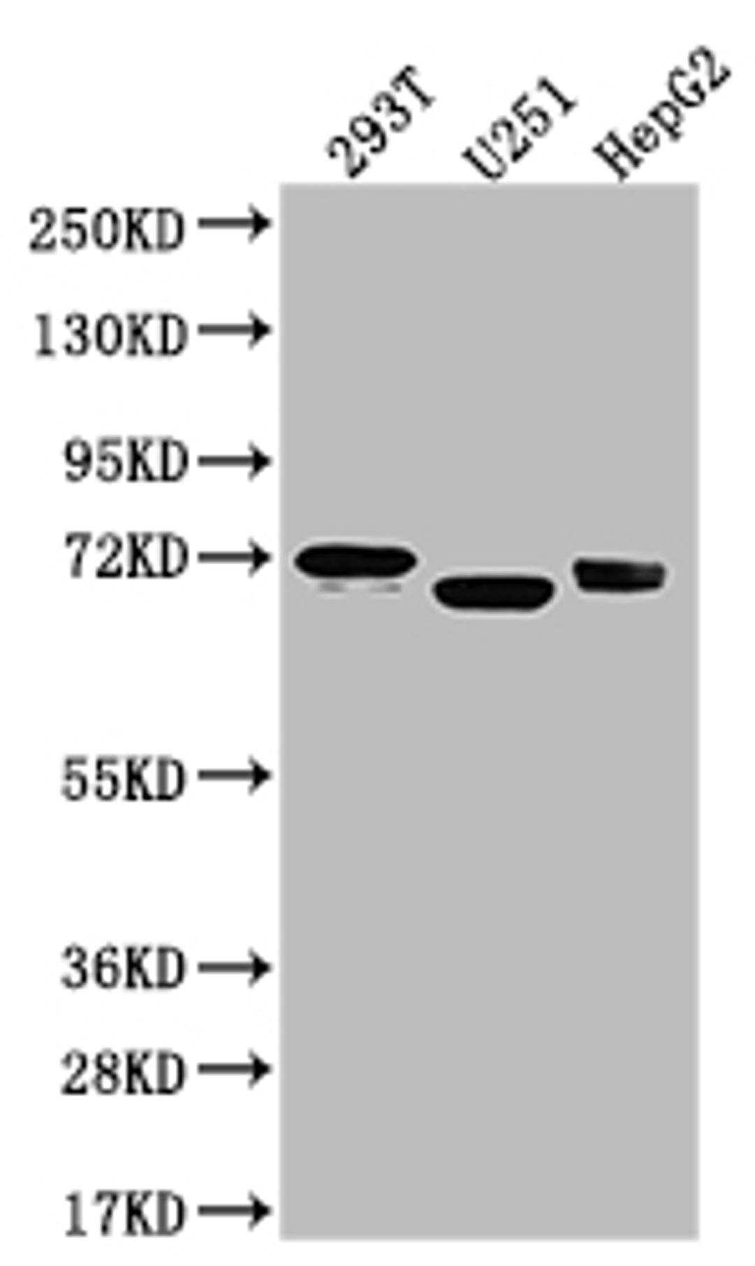 Western Blot. Positive WB detected in: U-87 whole cell lysate, 293T whole cell lysate, U-251 whole cell lysate, HepG2 whole cell lysate. All lanes: Serotonin transporter antibody at 1:1000. Secondary. Goat polyclonal to rabbit IgG at 1/50000 dilution. Predicted band size: 71, 75 kDa. Observed band size: 55 kDa. 