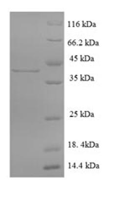 (Tris-Glycine gel) Discontinuous SDS-PAGE (reduced) with 5% enrichment gel and 15% separation gel.