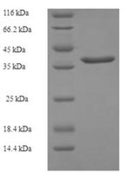 (Tris-Glycine gel) Discontinuous SDS-PAGE (reduced) with 5% enrichment gel and 15% separation gel.