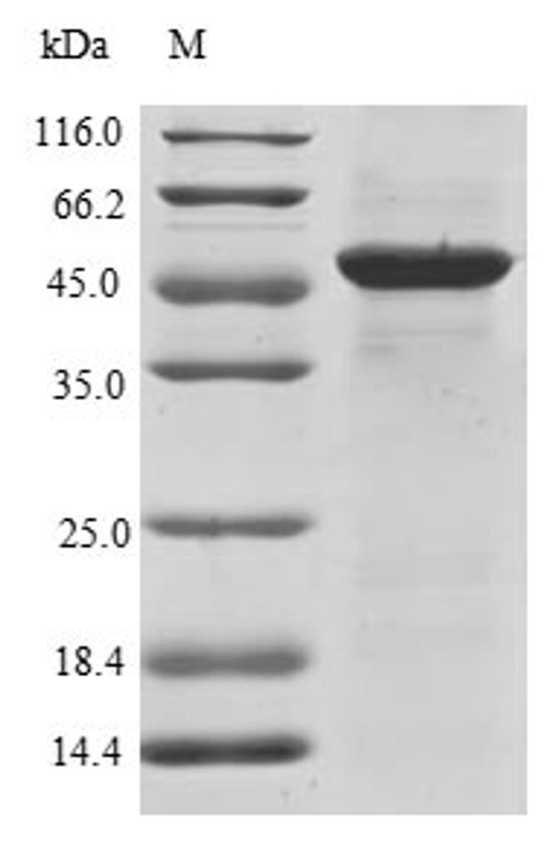 (Tris-Glycine gel) Discontinuous SDS-PAGE (reduced) with 5% enrichment gel and 15% separation gel.