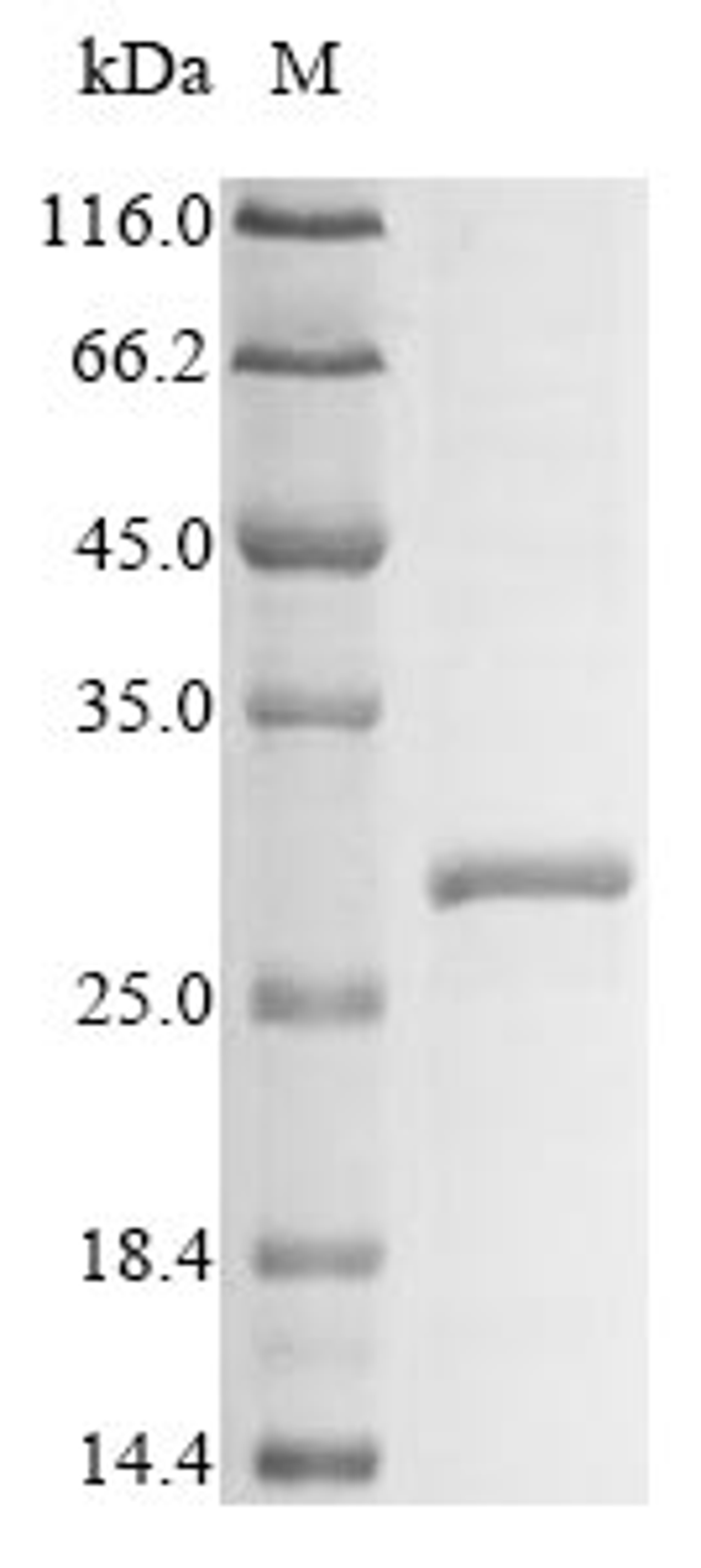 (Tris-Glycine gel) Discontinuous SDS-PAGE (reduced) with 5% enrichment gel and 15% separation gel.