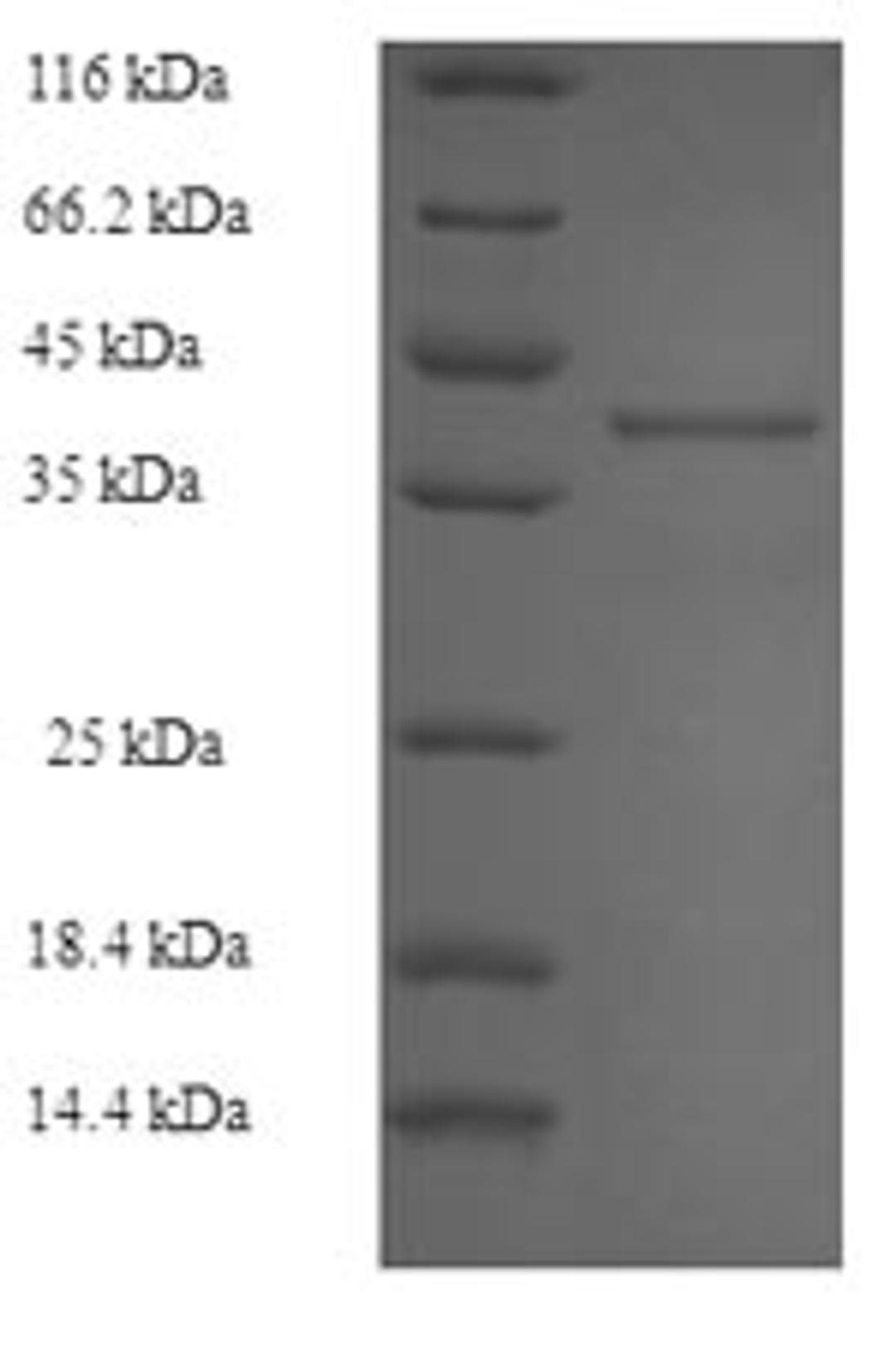(Tris-Glycine gel) Discontinuous SDS-PAGE (reduced) with 5% enrichment gel and 15% separation gel.