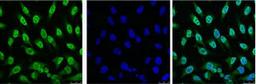 IF analysis of Hela with antibody (Left) and DAPI (Right) diluted at 1:100.