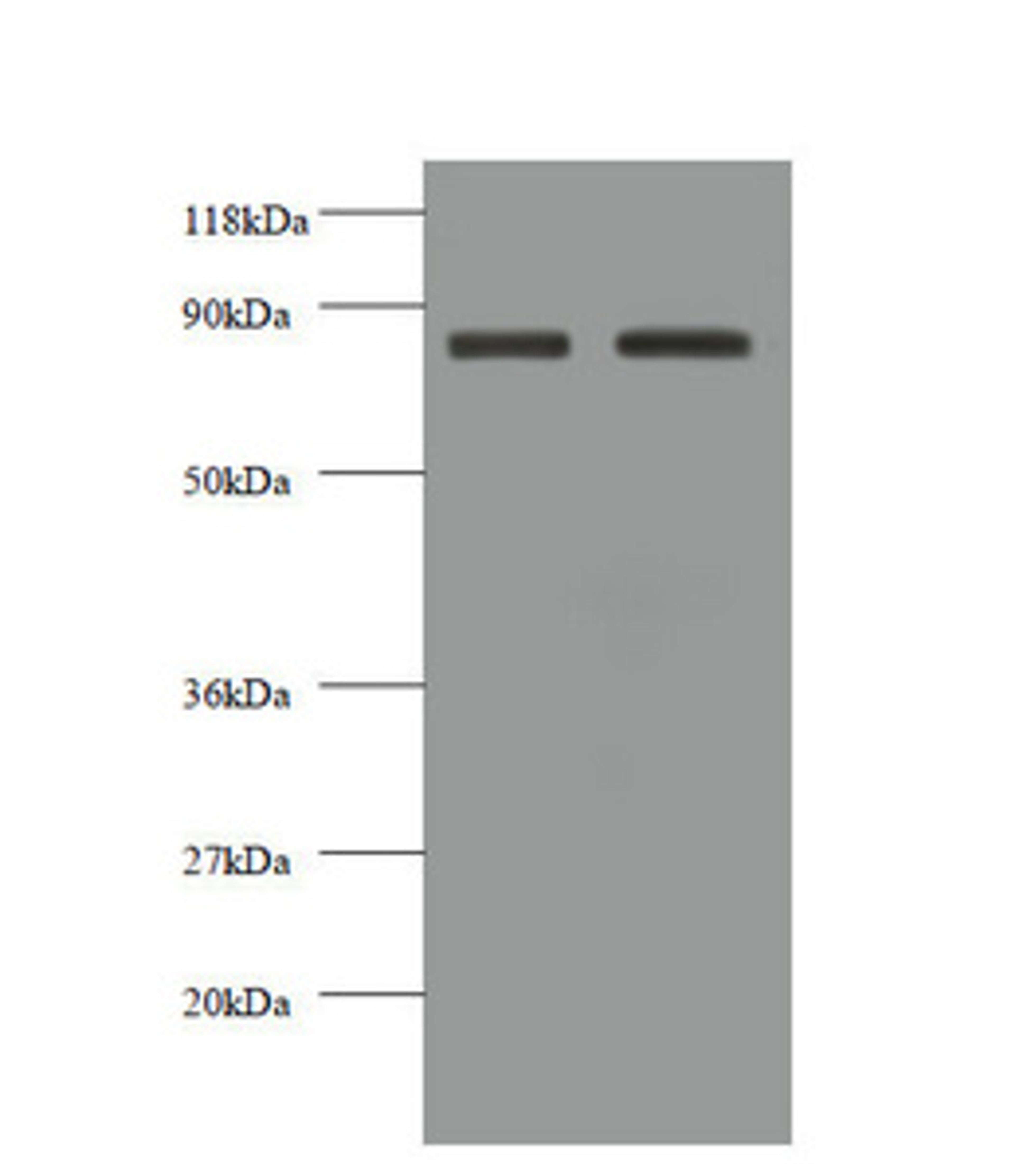 Western blot. All lanes: CDH12 antibody at 2µg/ml. Lane 1: EC109 whole cell lysate. Lane 2: 293T whole cell lysate. Secondary. Goat polyclonal to rabbit IgG at 1/10000 dilution. Predicted band size: 89, 85 kDa. Observed band size: 85 kDa