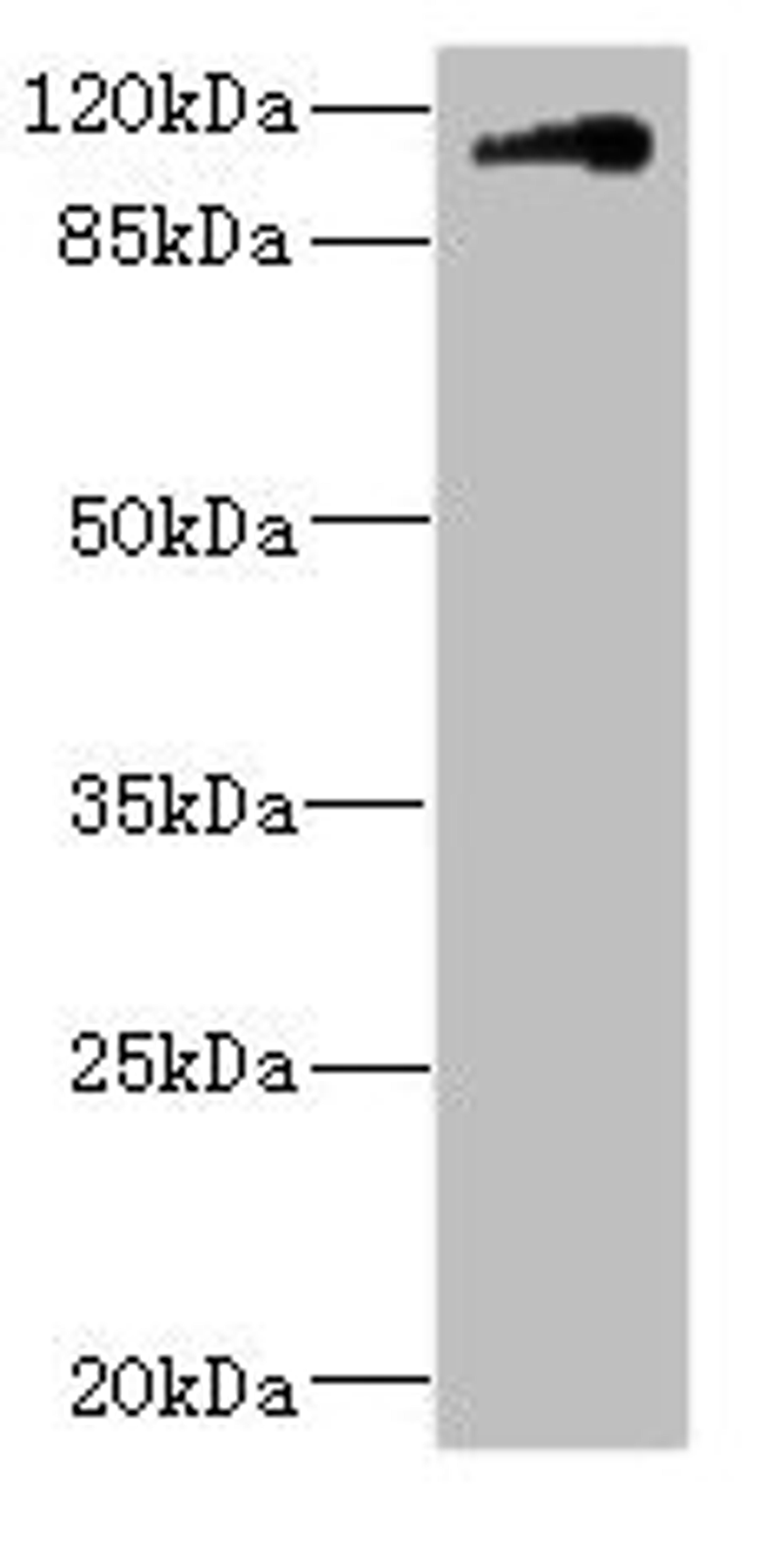 Western blot. All lanes: CNTN4 antibody IgG at 1.79ug/ml + HepG2 whole cell lysate. Secondary. Goat polyclonal to rabbit IgG at 1/10000 dilution. Predicted band size: 114, 32, 77 kDa. Observed band size: 114 kDa. 