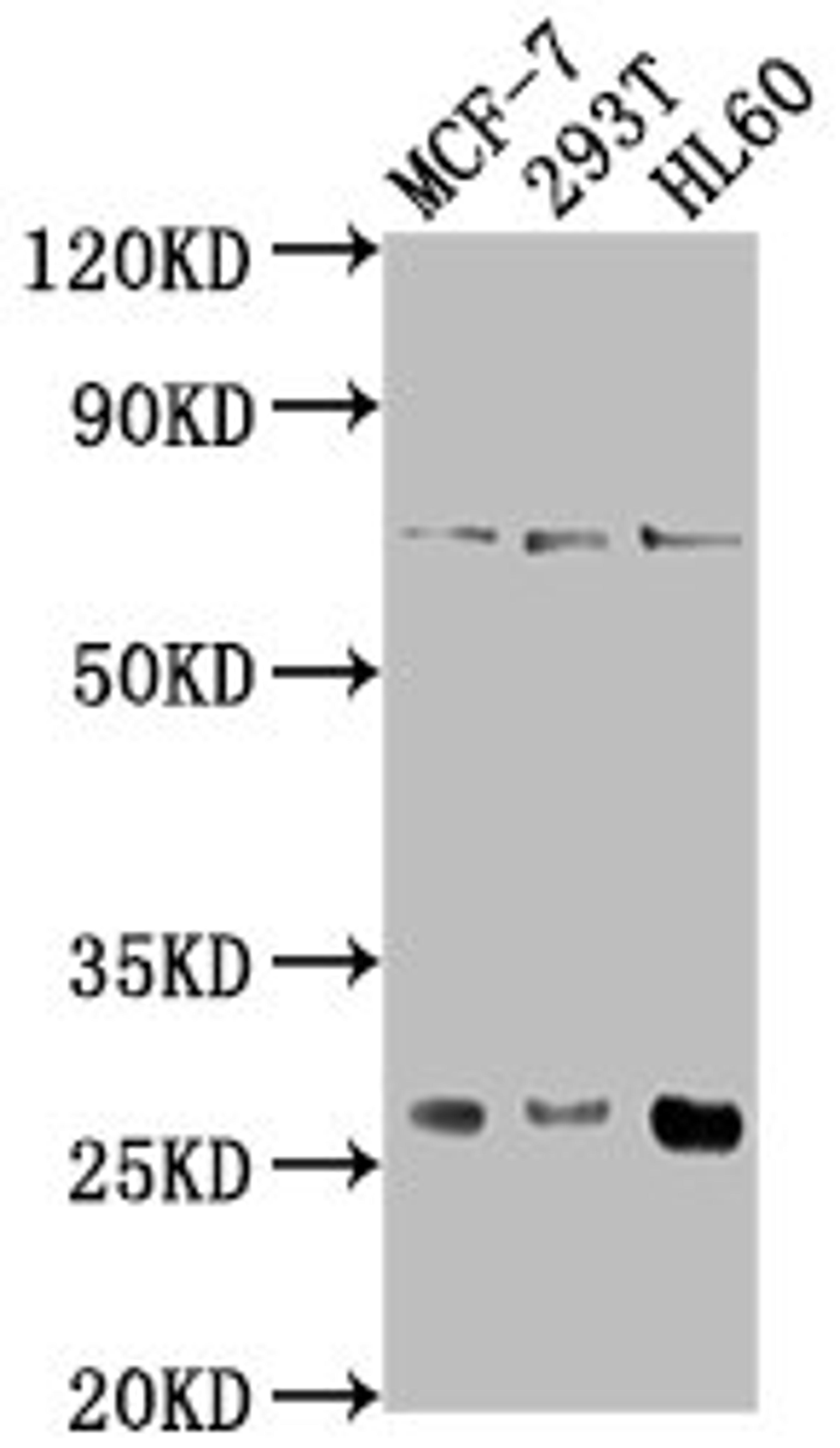 Western Blot. Positive WB detected in: MCF-7 whole cell lysate, 293T whole cell lysate, HL60 whole cell lysate. All lanes: STYX antibody at 1:1000. Secondary. Goat polyclonal to rabbit IgG at 1/50000 dilution. Predicted band size: 26 kDa. Observed band size: 26 kDa. 