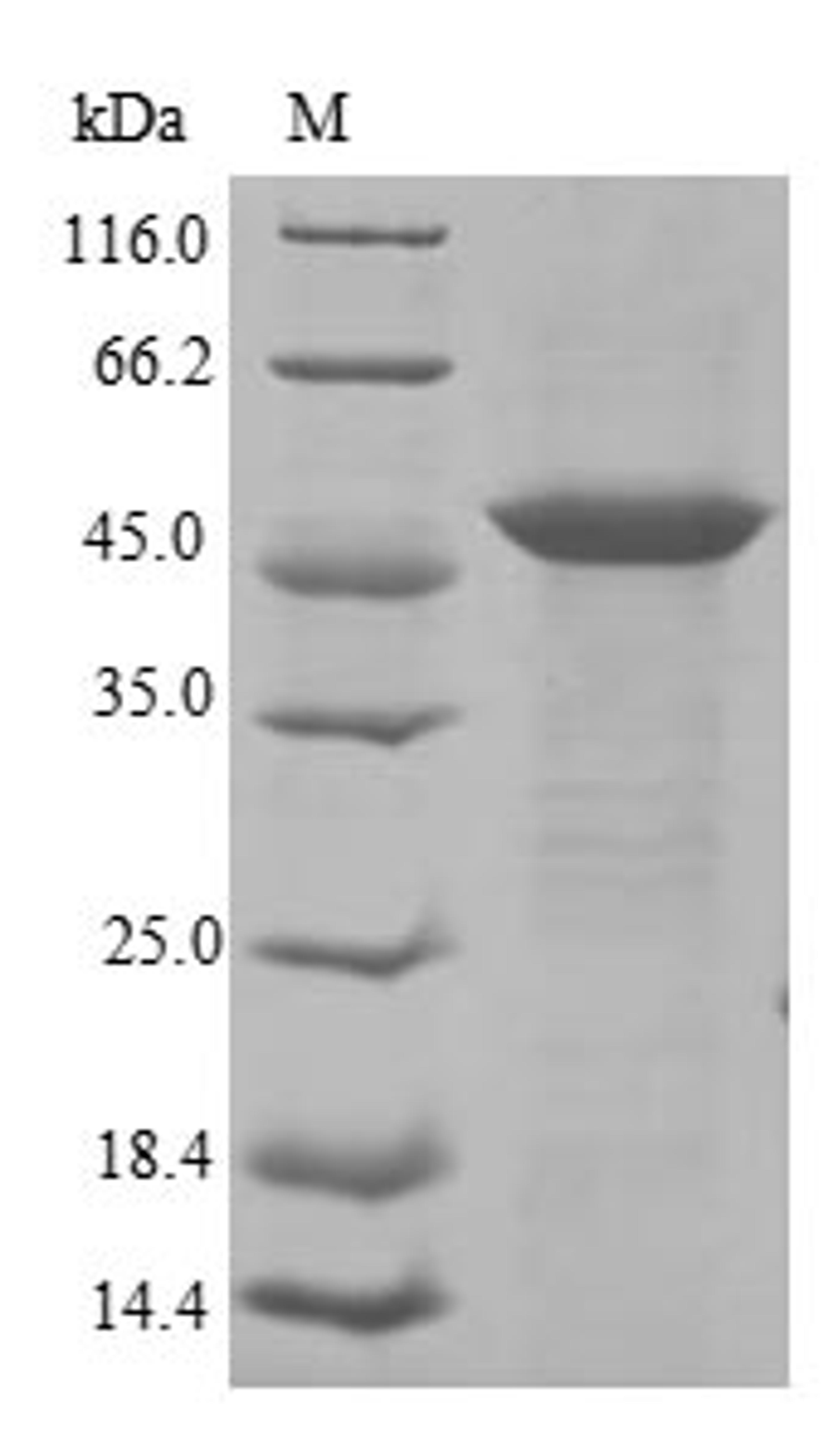 (Tris-Glycine gel) Discontinuous SDS-PAGE (reduced) with 5% enrichment gel and 15% separation gel.