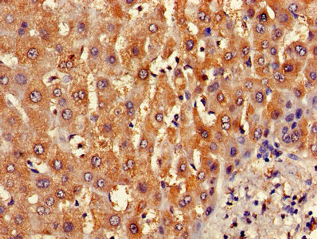 Immunohistochemistry of paraffin-embedded human liver tissue using CSB-PA002491LA01HU at dilution of 1:100