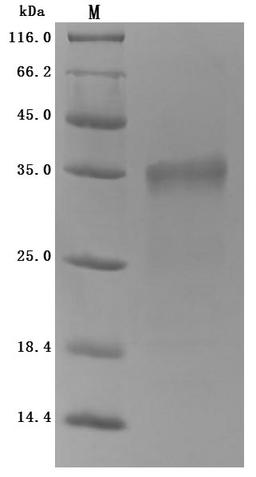 (Tris-Glycine gel) Discontinuous SDS-PAGE (reduced) with 5% enrichment gel and 15% separation gel.