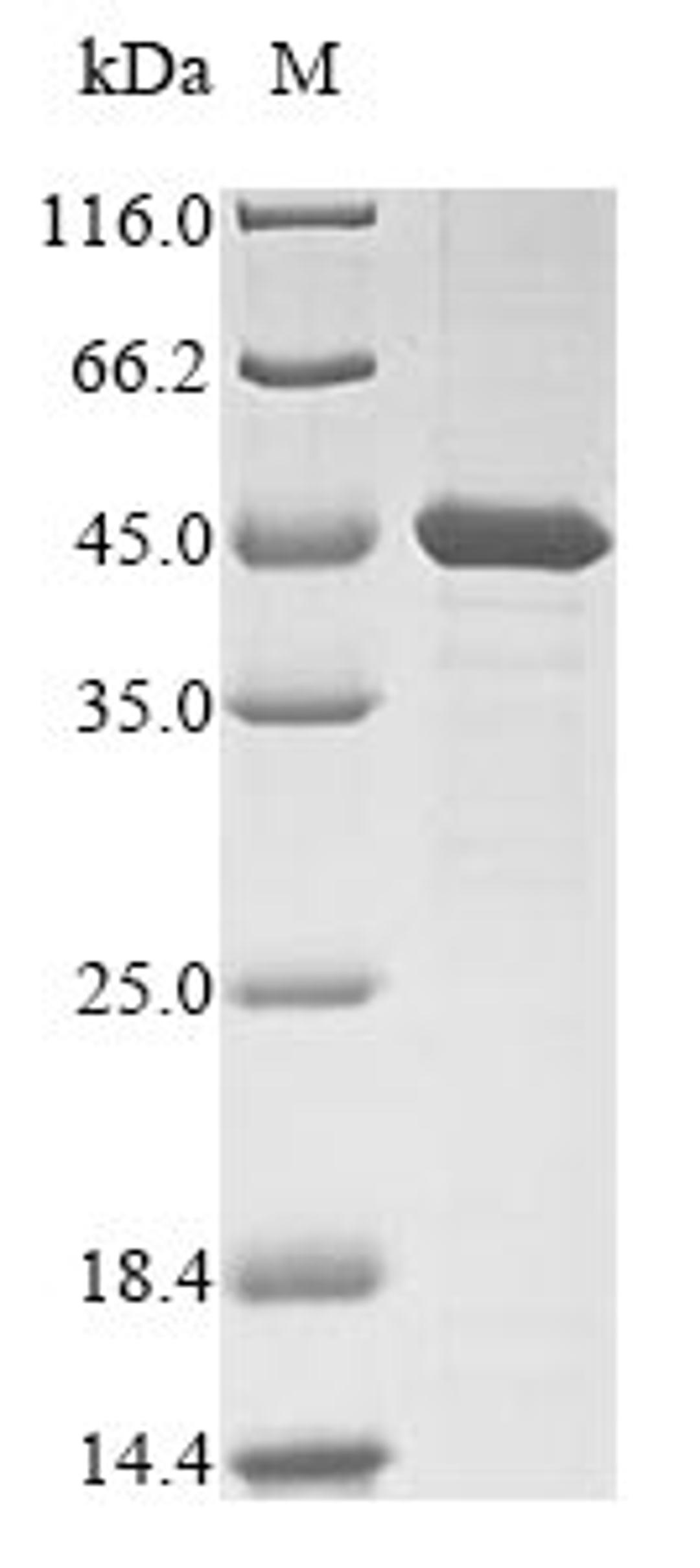 (Tris-Glycine gel) Discontinuous SDS-PAGE (reduced) with 5% enrichment gel and 15% separation gel.