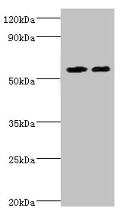 Western blot. All lanes: ALDH4A1 antibody at 13µg/ml. Lane 1: K562 whole cell lysate. Lane 2: 293T whole cell lysate. Secondary. Goat polyclonal to rabbit IgG&nbsp;at 1/10000 dilution. Predicted band size: 62, 56, 57 kDa. Observed band size: 62 kDa