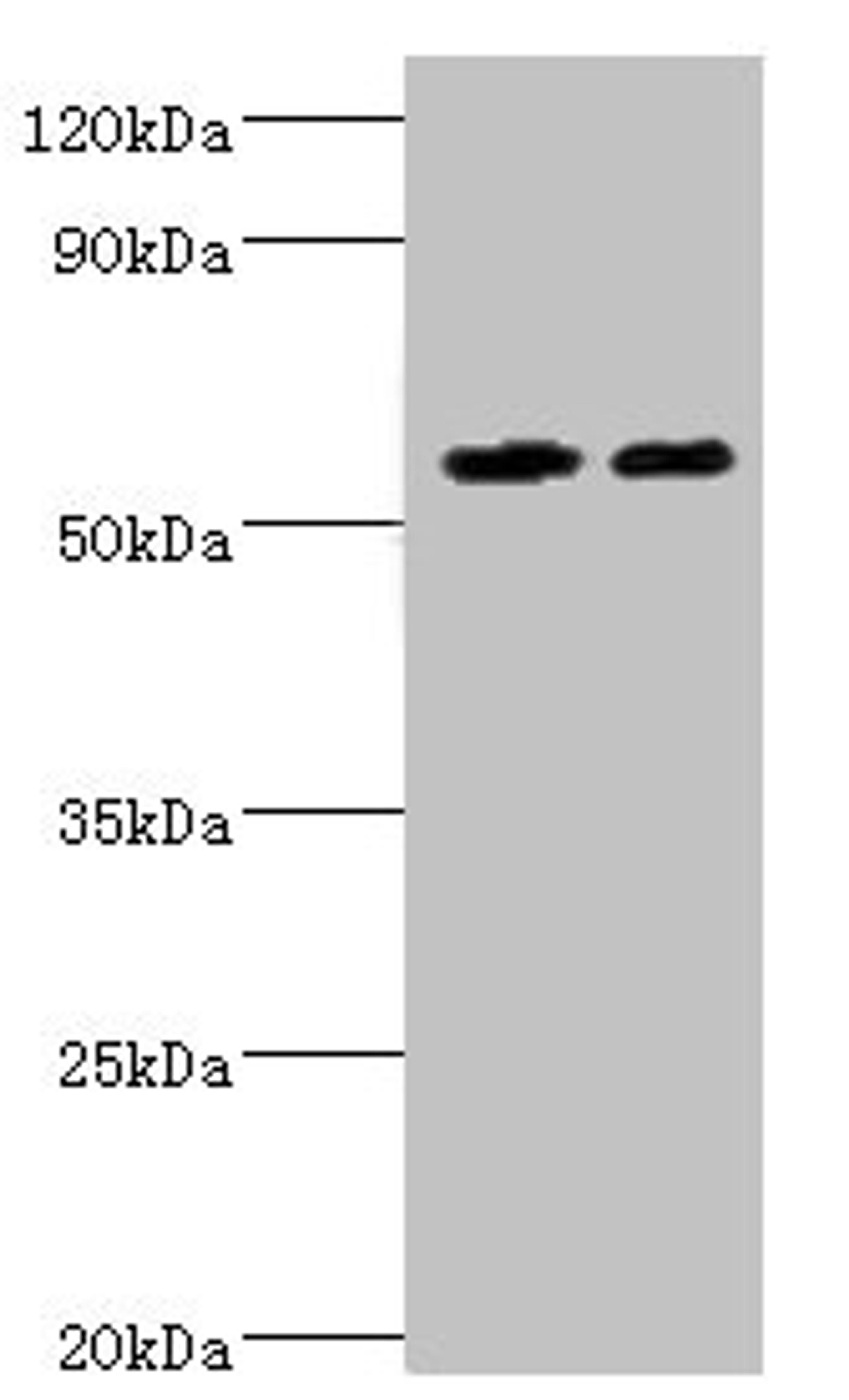 Western blot. All lanes: ALDH4A1 antibody at 13µg/ml. Lane 1: K562 whole cell lysate. Lane 2: 293T whole cell lysate. Secondary. Goat polyclonal to rabbit IgG&nbsp;at 1/10000 dilution. Predicted band size: 62, 56, 57 kDa. Observed band size: 62 kDa