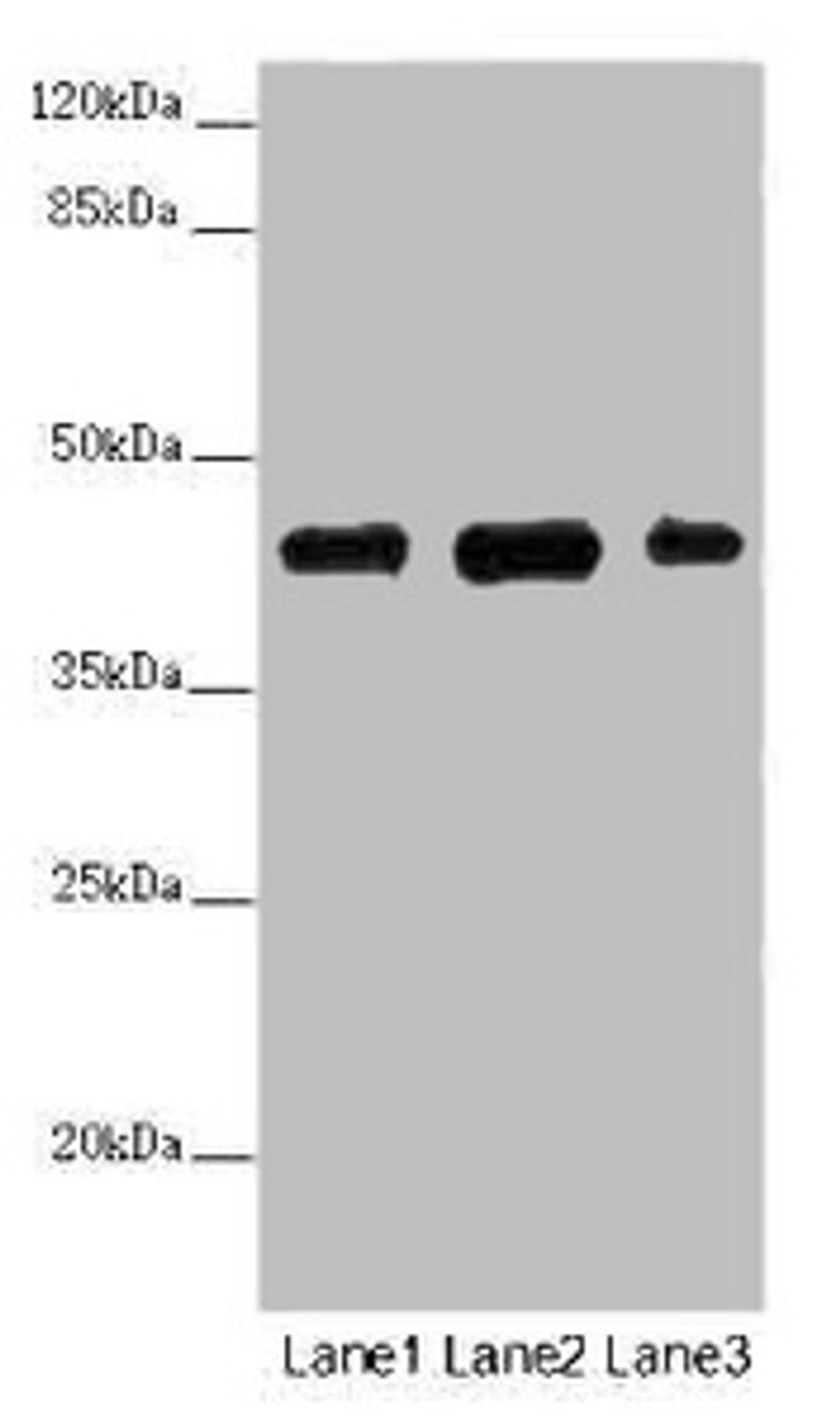 Western blot. All lanes: SS18L1 antibody at 2 ug/ml. Lane 1: Mouse kidney tissue. Lane 2: Mouse lung tissue. Lane 3: Mouse spleen tissue. Secondary. Goat polyclonal to rabbit IgG at 1/10000 dilution. Predicted band size: 43, 41, 34, 30, 44 kDa. Observed band size: 43 kDa. 