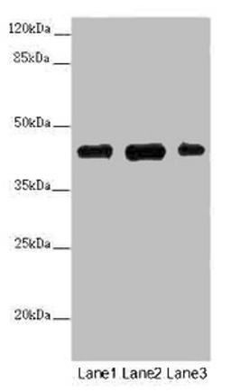 Western blot. All lanes: SS18L1 antibody at 2 ug/ml. Lane 1: Mouse kidney tissue. Lane 2: Mouse lung tissue. Lane 3: Mouse spleen tissue. Secondary. Goat polyclonal to rabbit IgG at 1/10000 dilution. Predicted band size: 43, 41, 34, 30, 44 kDa. Observed band size: 43 kDa. 