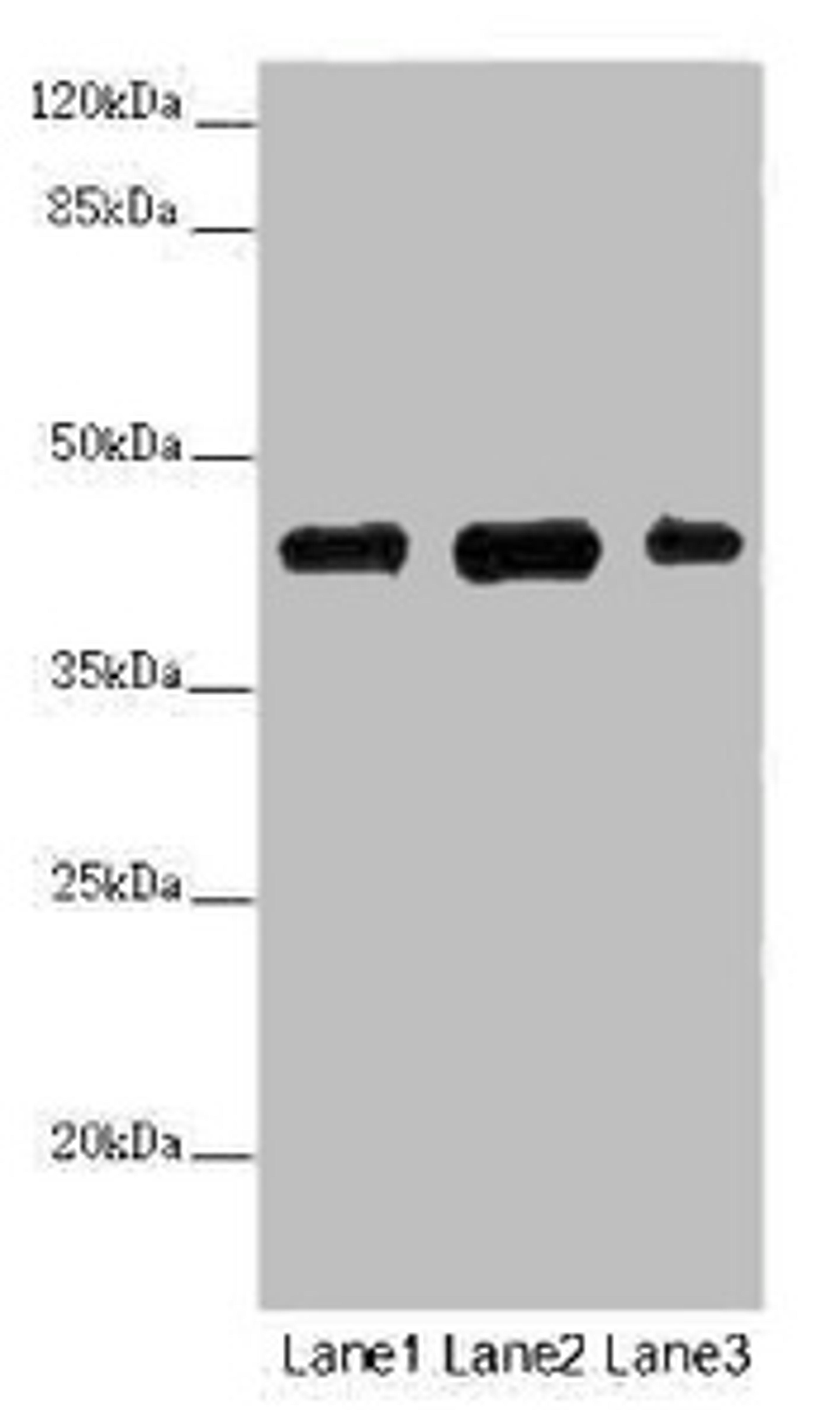 Western blot. All lanes: SS18L1 antibody at 2 ug/ml. Lane 1: Mouse kidney tissue. Lane 2: Mouse lung tissue. Lane 3: Mouse spleen tissue. Secondary. Goat polyclonal to rabbit IgG at 1/10000 dilution. Predicted band size: 43, 41, 34, 30, 44 kDa. Observed band size: 43 kDa. 