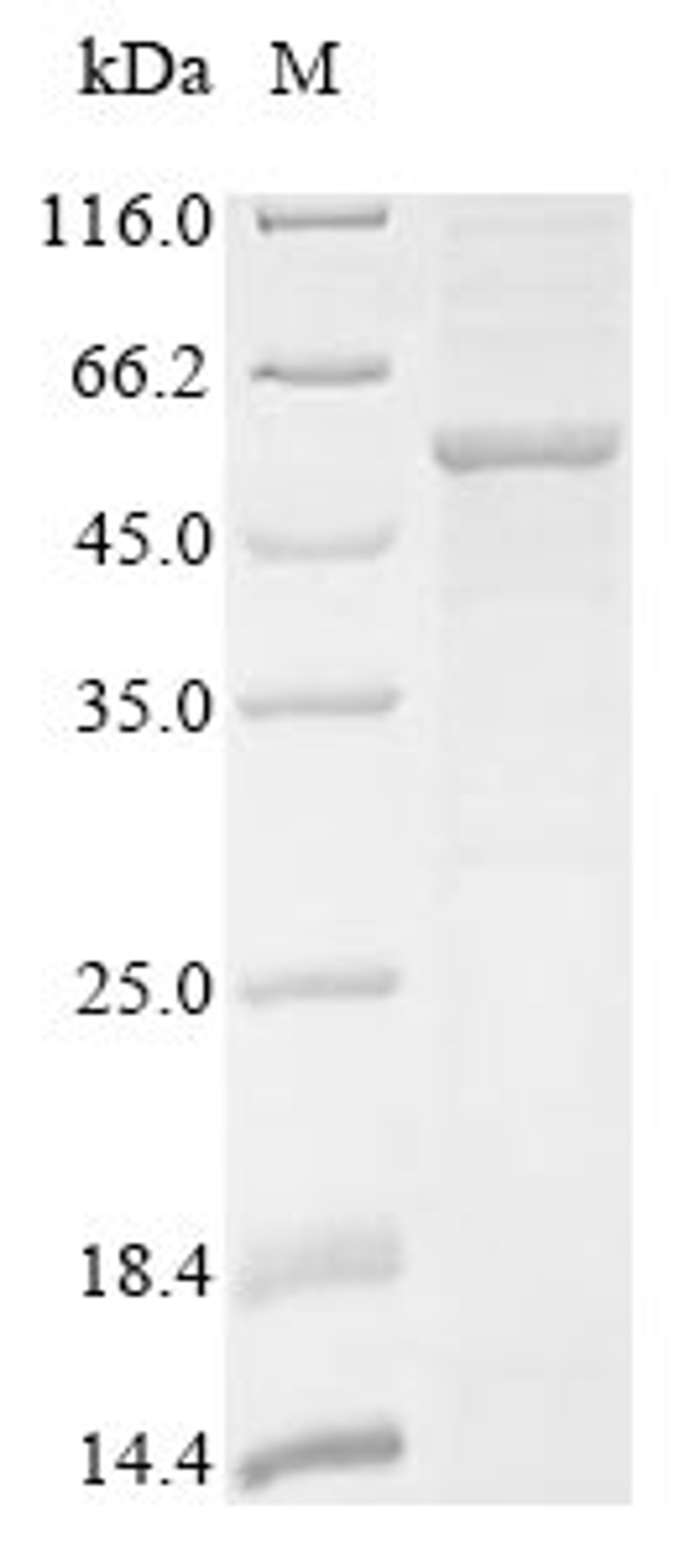 (Tris-Glycine gel) Discontinuous SDS-PAGE (reduced) with 5% enrichment gel and 15% separation gel.