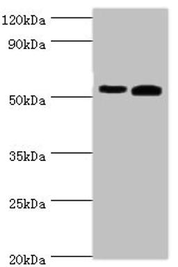 Western blot. All lanes: Retinal dehydrogenase 2 antibody at 14ug/ml. Lane 1: K562 whole cell lysate. Lane 2: Mouse liver tissue. Secondary. Goat polyclonal to rabbit IgG at 1/10000 dilution. Predicted band size: 57, 54, 55, 47 kDa. Observed band size: 57 kDa. 