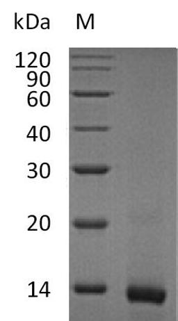 (Tris-Glycine gel) Discontinuous SDS-PAGE (reduced) with 5% enrichment gel and 15% separation gel.