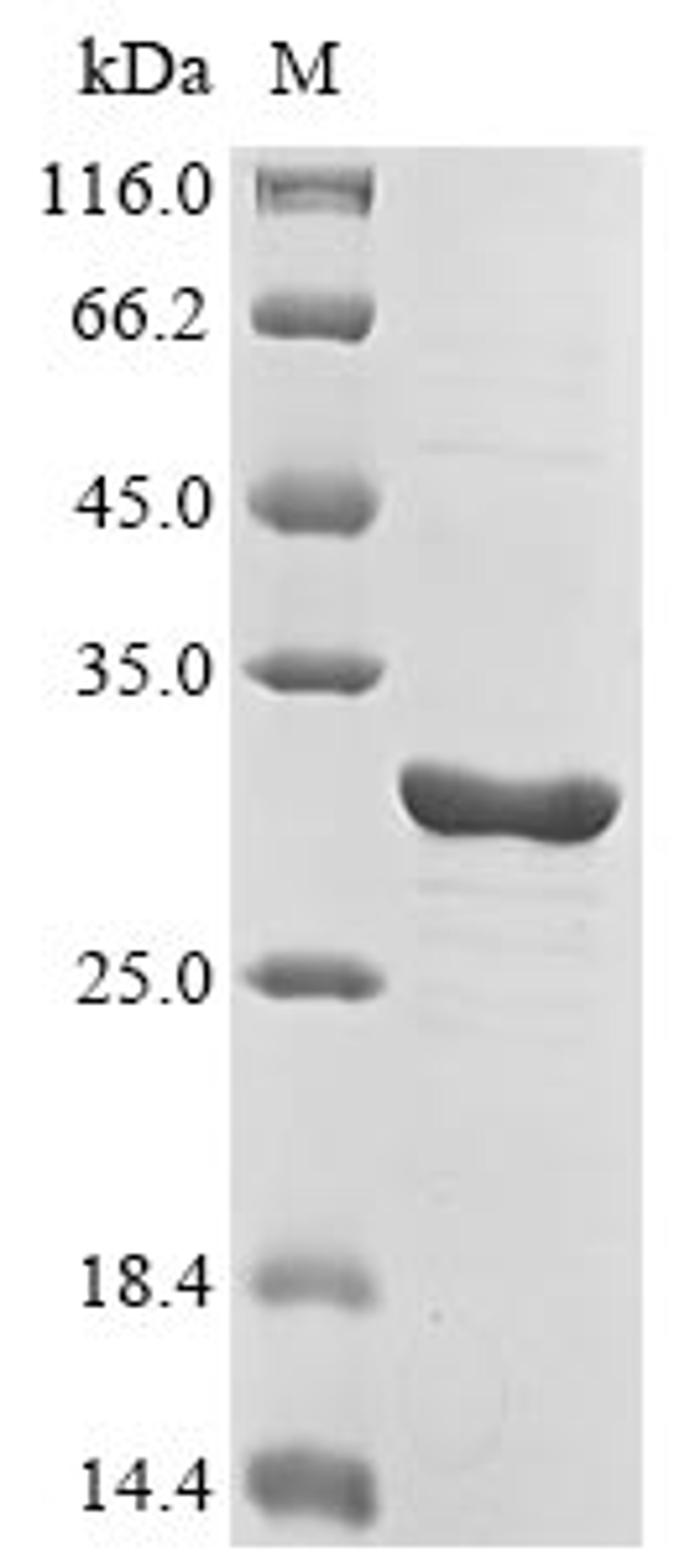 (Tris-Glycine gel) Discontinuous SDS-PAGE (reduced) with 5% enrichment gel and 15% separation gel.