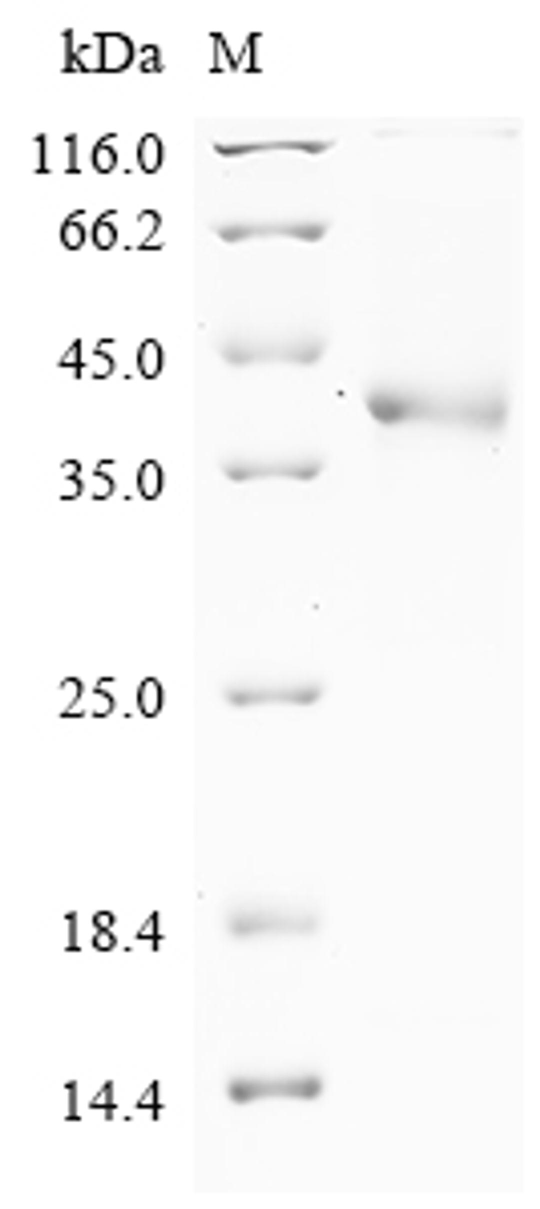 (Tris-Glycine gel) Discontinuous SDS-PAGE (reduced) with 5% enrichment gel and 15% separation gel.