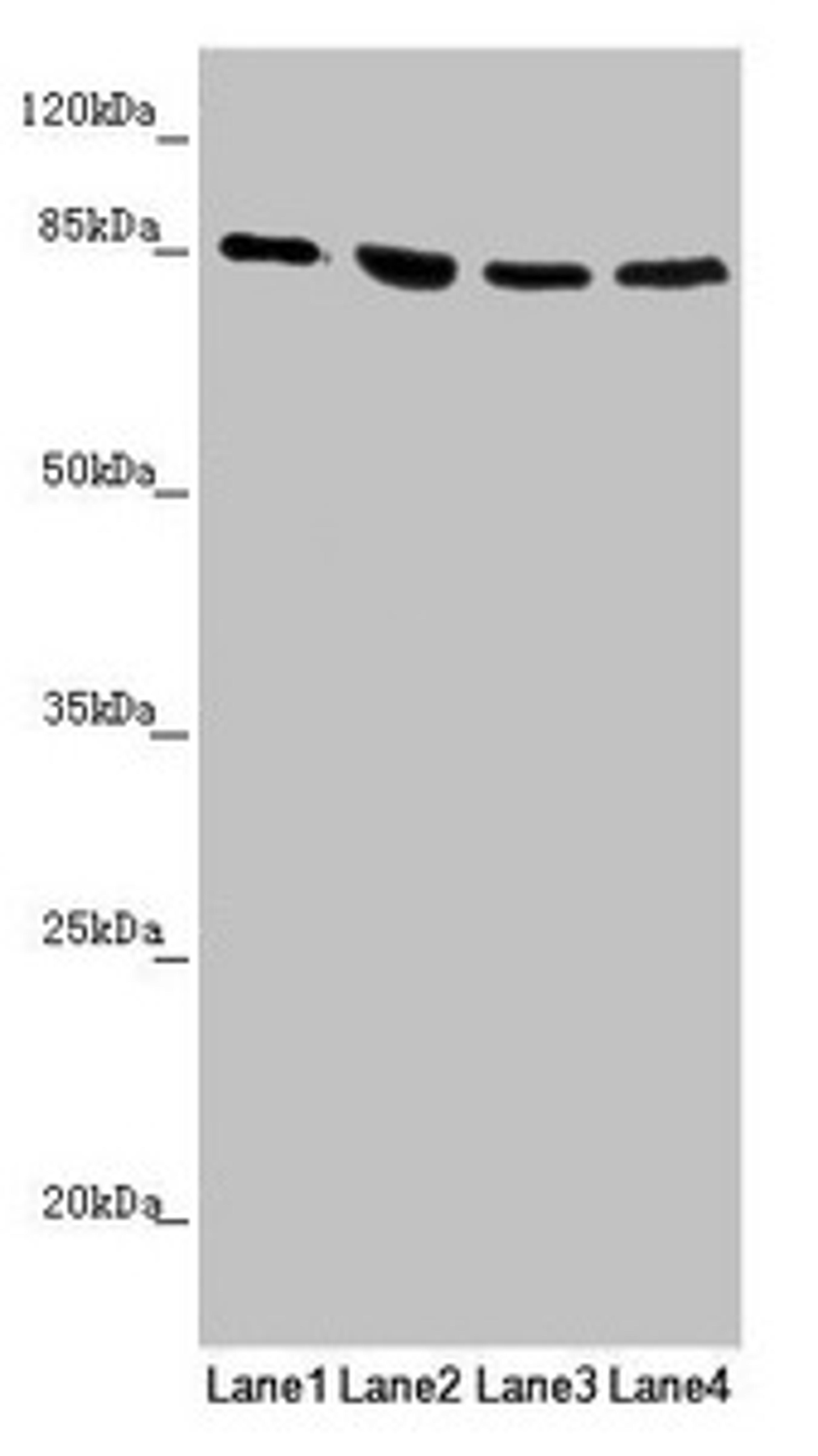Western blot. All lanes: MFN1 antibody at 1.1ug/ml. Lane 1: Human placenta tissue. Lane 2: Jurkat whole cell lysate. Lane 3: Hela whole cell lysate. Lane 4: K562 whole cell lysate. Secondary. Goat polyclonal to rabbit IgG at 1/10000 dilution. Predicted band size: 85, 42, 72 kDa. Observed band size: 85 kDa. 