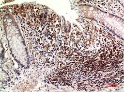 Immunohistochemical analysis of paraffin-embedded Human Colon Carcinoma Tissue using Epsilon Tubulin Mouse mAb diluted at 1:200.