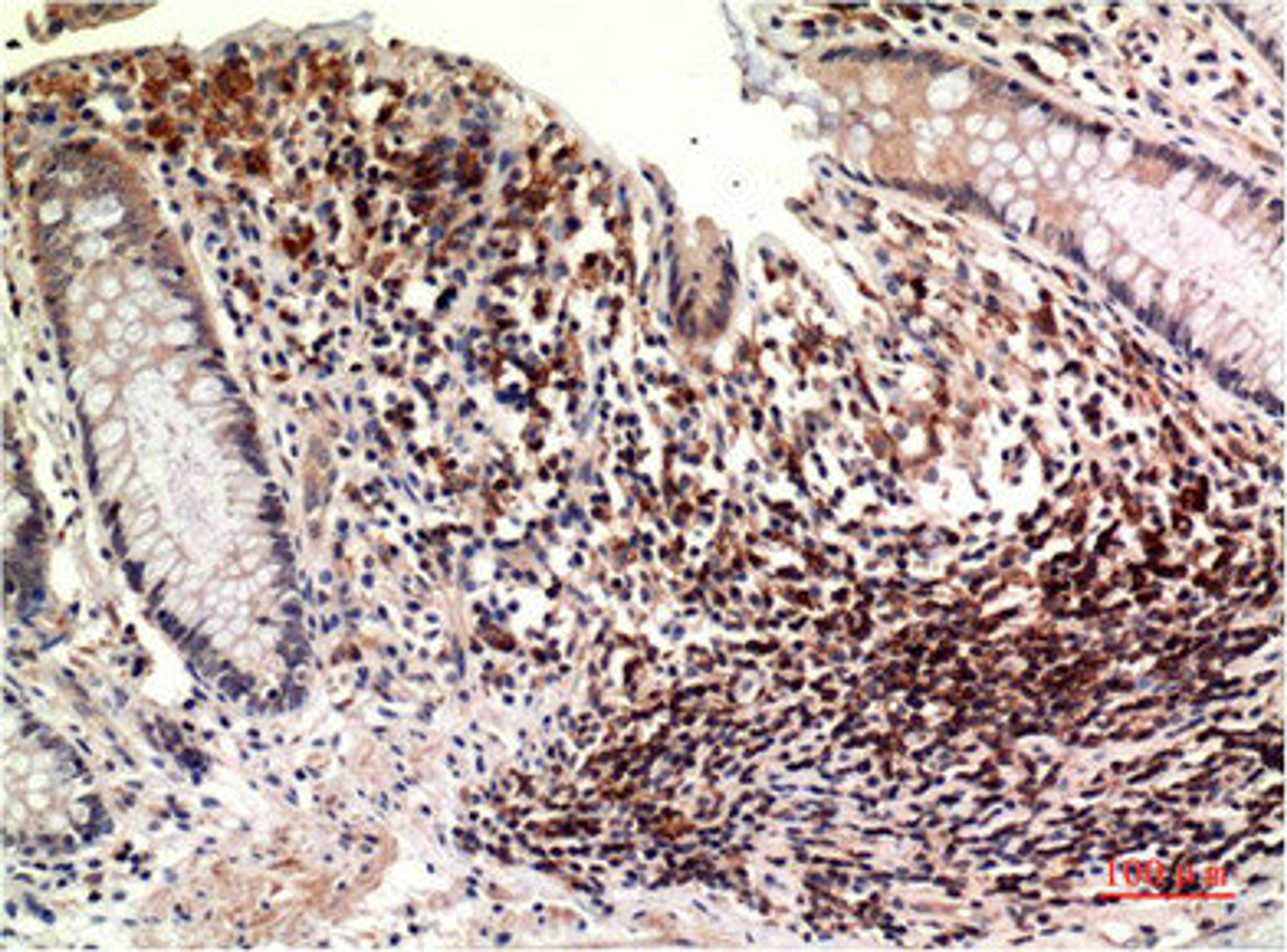Immunohistochemical analysis of paraffin-embedded Human Colon Carcinoma Tissue using Epsilon Tubulin Mouse mAb diluted at 1:200.