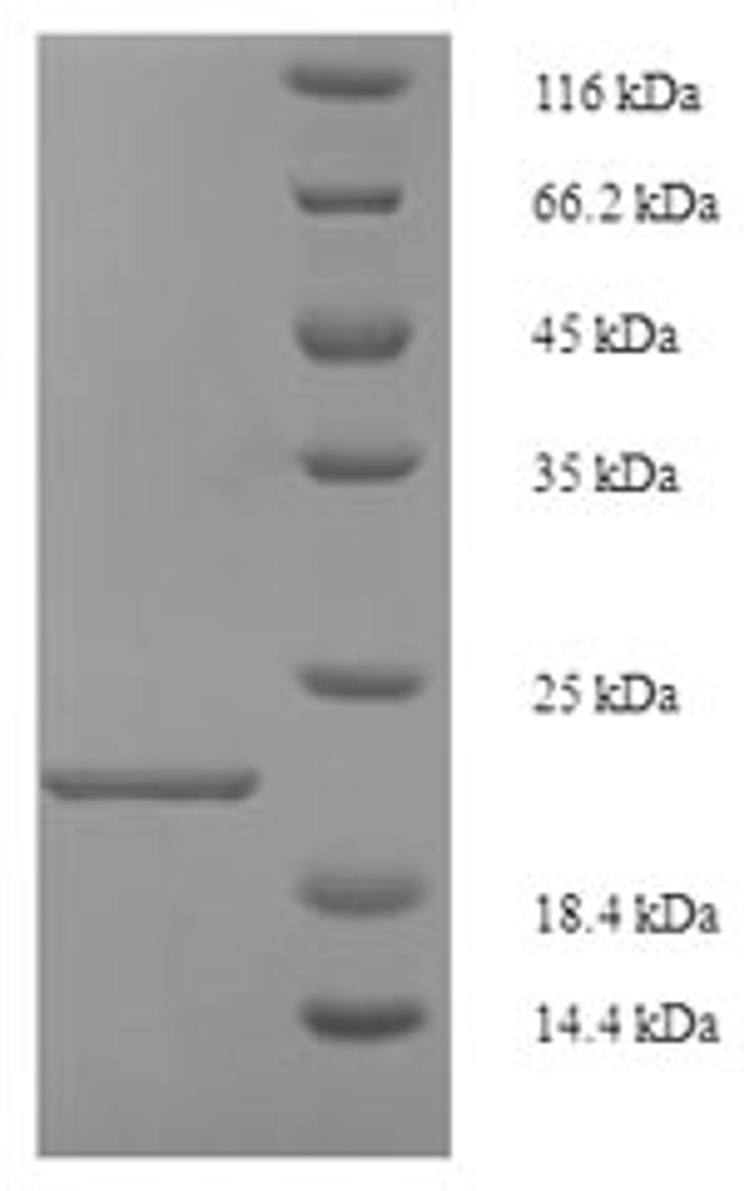 (Tris-Glycine gel) Discontinuous SDS-PAGE (reduced) with 5% enrichment gel and 15% separation gel.