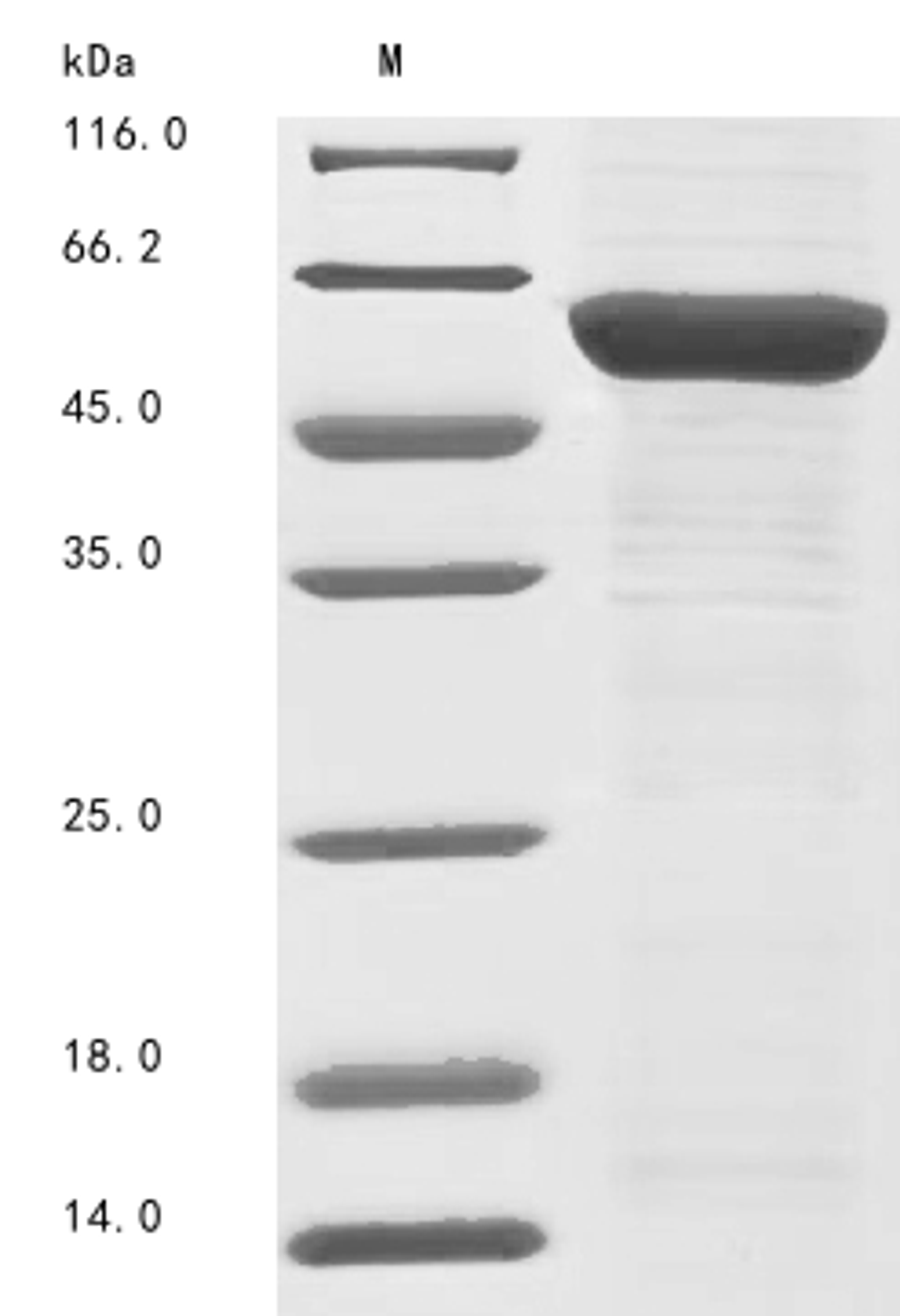 (Tris-Glycine gel) Discontinuous SDS-PAGE (reduced) with 5% enrichment gel and 15% separation gel.