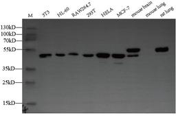 Western Blot. Positive WB detected in: NIH/3T3 whole cell lysate, HL-60 whole cell lysate, RAW264.7 whole cell lysate. All lanes: ZDHHC6 antibody at 1:2000. Secondary. Goat polyclonal to rabbit IgG at 1/50000 dilution. Predicted band size: 48 kDa. Observed band size: 48 kDa. 