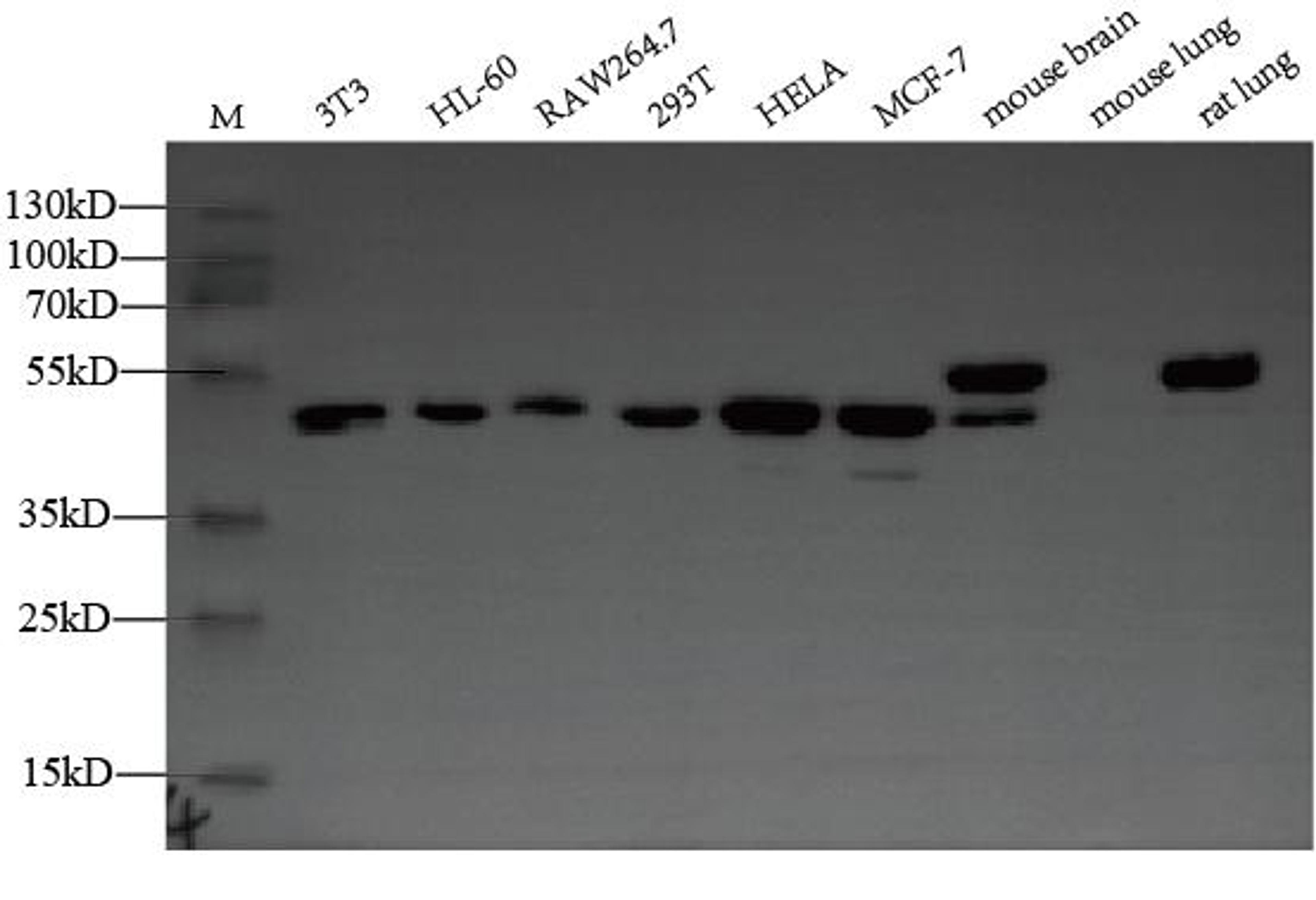 Western Blot. Positive WB detected in: NIH/3T3 whole cell lysate, HL-60 whole cell lysate, RAW264.7 whole cell lysate. All lanes: ZDHHC6 antibody at 1:2000. Secondary. Goat polyclonal to rabbit IgG at 1/50000 dilution. Predicted band size: 48 kDa. Observed band size: 48 kDa. 