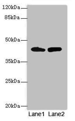 Western blot. All lanes: NMUR1 antibody at 2ug/ml. Lane 1: Mouse liver tissue. Lane 2: Mouse kidney tissue. Secondary. Goat polyclonal to rabbit IgG at 1/10000 dilution. Predicted band size: 47 kDa. Observed band size: 47 kDa. 