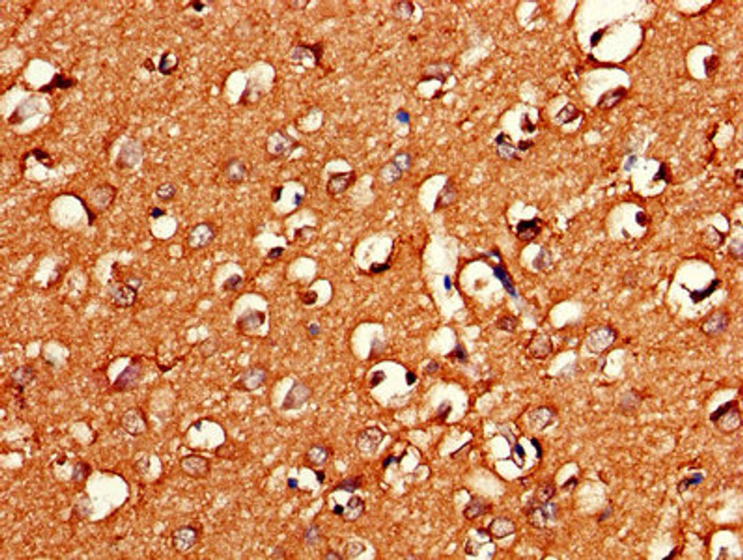 Immunohistochemistry of paraffin-embedded human brain tissue using CSB-PA009611LA01HU at dilution of 1:100