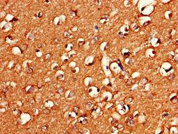 Immunohistochemistry of paraffin-embedded human brain tissue using CSB-PA009611LA01HU at dilution of 1:100