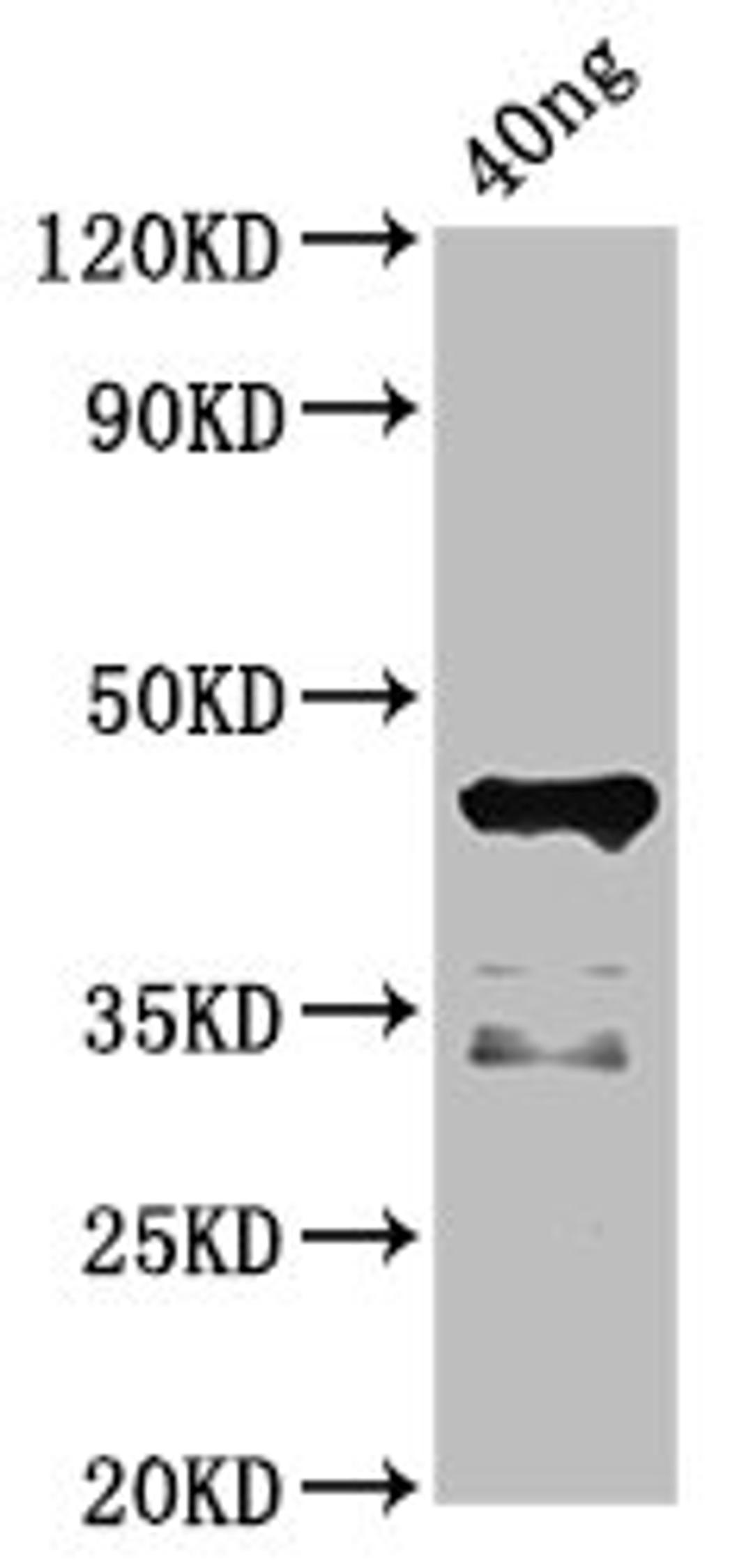 Western Blot. Positive WB detected in Recombinant protein. All lanes: ligA antibody at 4.5ug/ml. Secondary. Goat polyclonal to rabbit IgG at 1/50000 dilution. Predicted band size: 45 kDa. Observed band size: 45 kDa. 