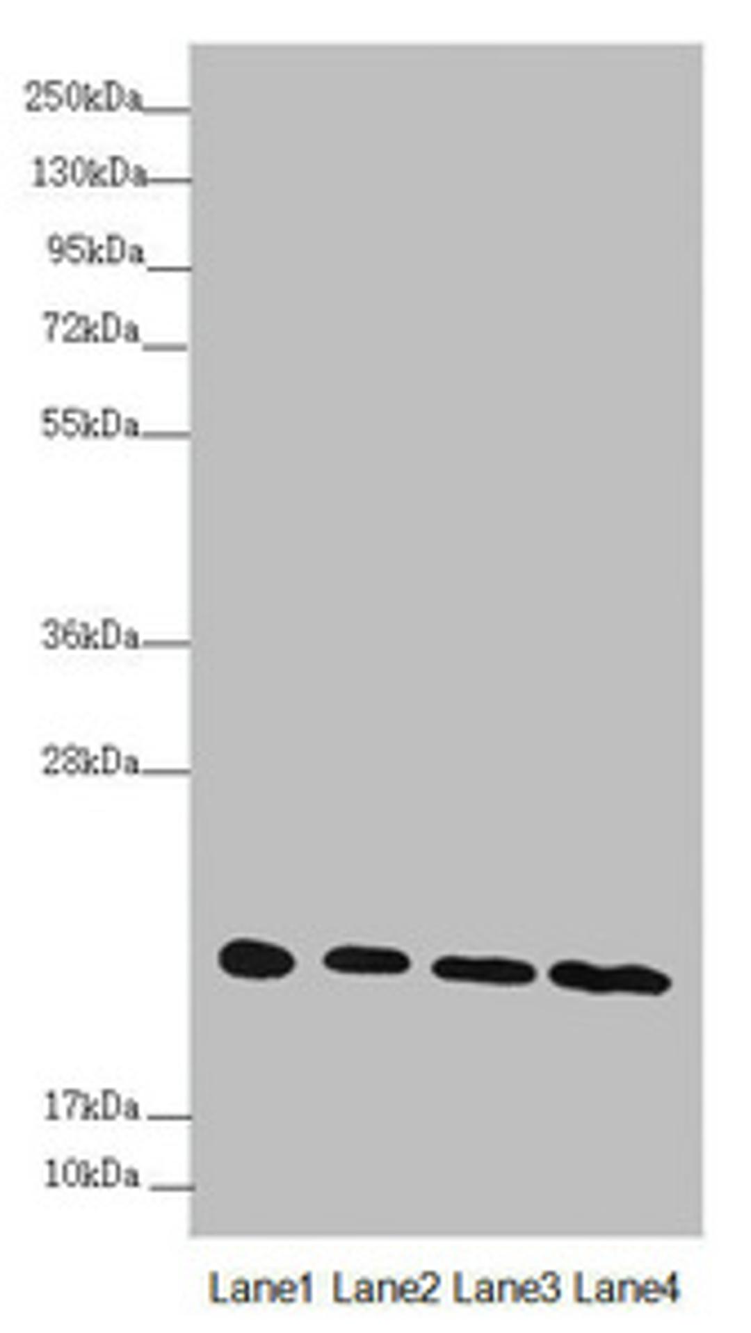 Western blot. All lanes: NDUFB10 antibody at 3.04 ug/ml. Lane 1: Hela whole cell lysate. Lane 2: Jurkat whole cell lysate. Lane 3: HepG2 whole cell lysate. Lane 4: 293T whole cell lysate. Secondary. Goat polyclonal to rabbit IgG at 1/10000 dilution. Predicted band size: 21 kDa. Observed band size: 21 kDa. 