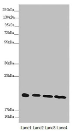 Western blot. All lanes: NDUFB10 antibody at 3.04 ug/ml. Lane 1: Hela whole cell lysate. Lane 2: Jurkat whole cell lysate. Lane 3: HepG2 whole cell lysate. Lane 4: 293T whole cell lysate. Secondary. Goat polyclonal to rabbit IgG at 1/10000 dilution. Predicted band size: 21 kDa. Observed band size: 21 kDa. 