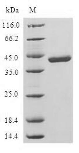 (Tris-Glycine gel) Discontinuous SDS-PAGE (reduced) with 5% enrichment gel and 15% separation gel.