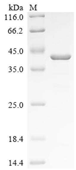 (Tris-Glycine gel) Discontinuous SDS-PAGE (reduced) with 5% enrichment gel and 15% separation gel.
