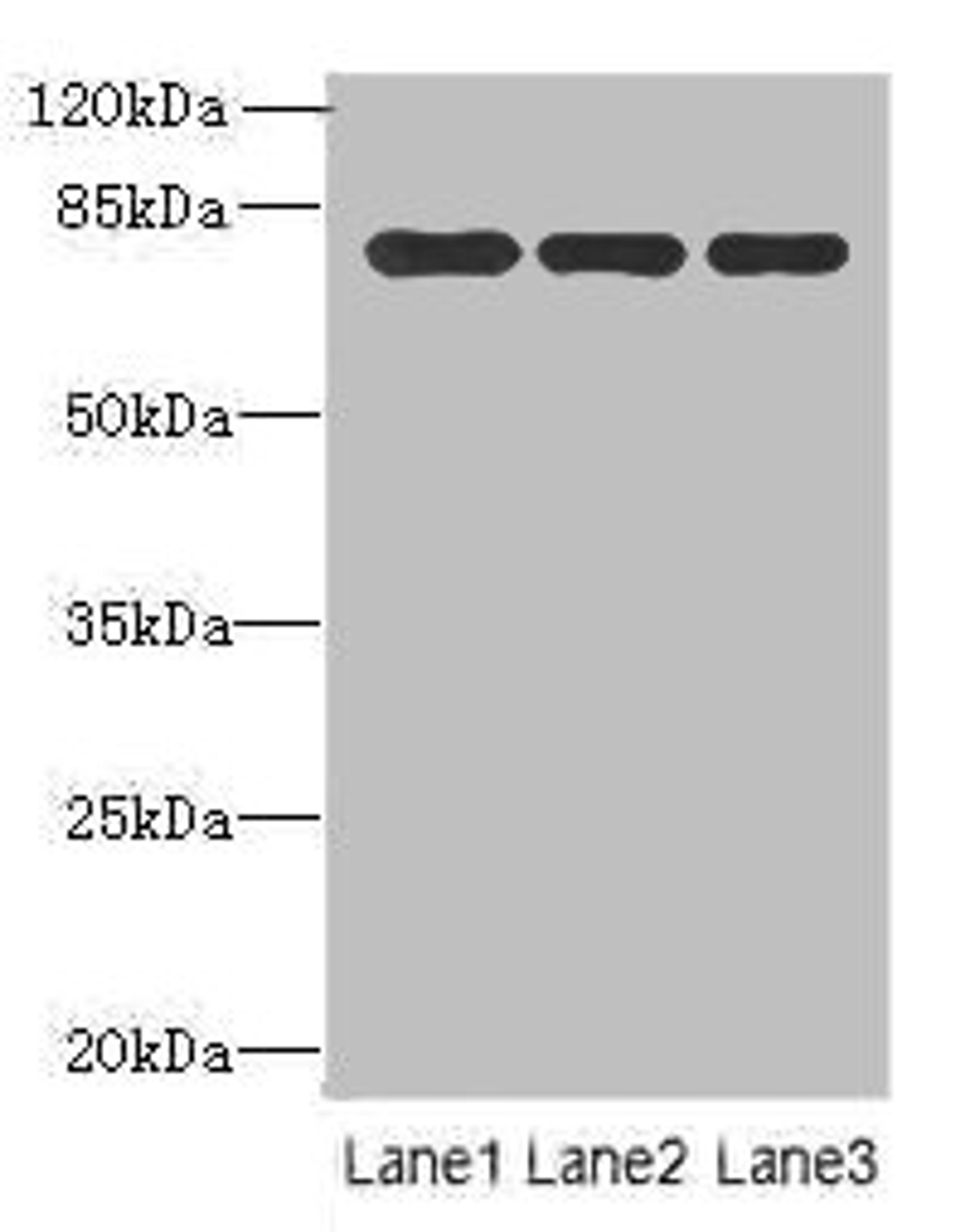 Western blot. All lanes: Xaa-Pro aminopeptidase 1 antibody at 8ug/ml. Lane 1: Mouse small intestine tissue. Lane 2: Mouse stomach tissue. Lane 3: Mouse kidney tissue. Secondary. Goat polyclonal to rabbit IgG at 1/10000 dilution. Predicted band size: 70, 68, 75, 73 kDa. Observed band size: 70 kDa.