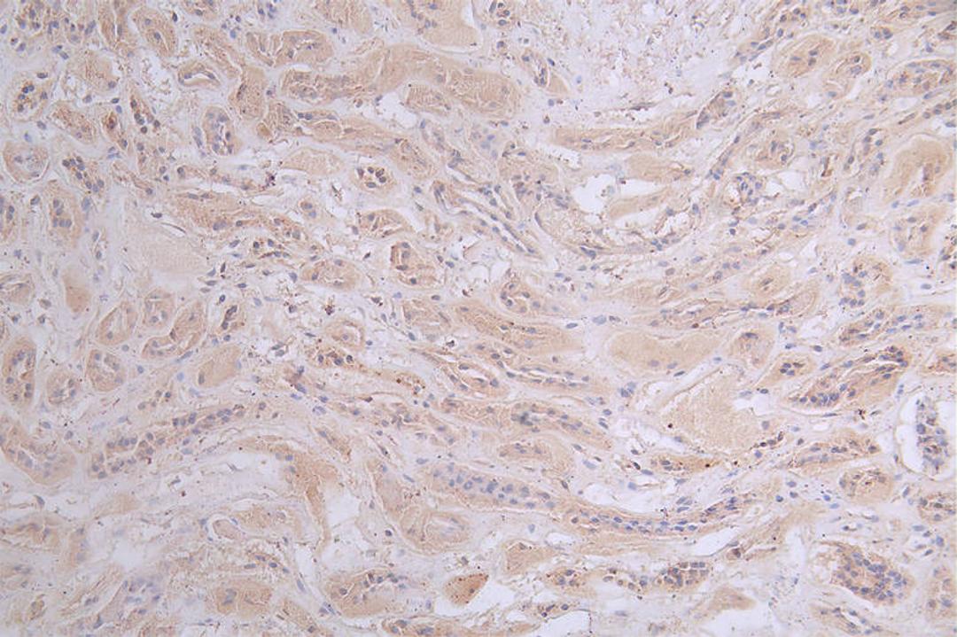 IHC image of CSB-RA197122A0HU diluted at 1:50 and staining in paraffin-embedded human kidney tissue performed on a Leica BondTM system. After dewaxing and hydration, antigen retrieval was mediated by high pressure in a citrate buffer (pH 6.0). Section was blocked with 10% normal goat serum 30min at RT. Then primary antibody (1% BSA) was incubated at 4°C overnight. The primary is detected by a Goat anti-rabbit polymer IgG labeled by HRP and visualized using 0.47% DAB.