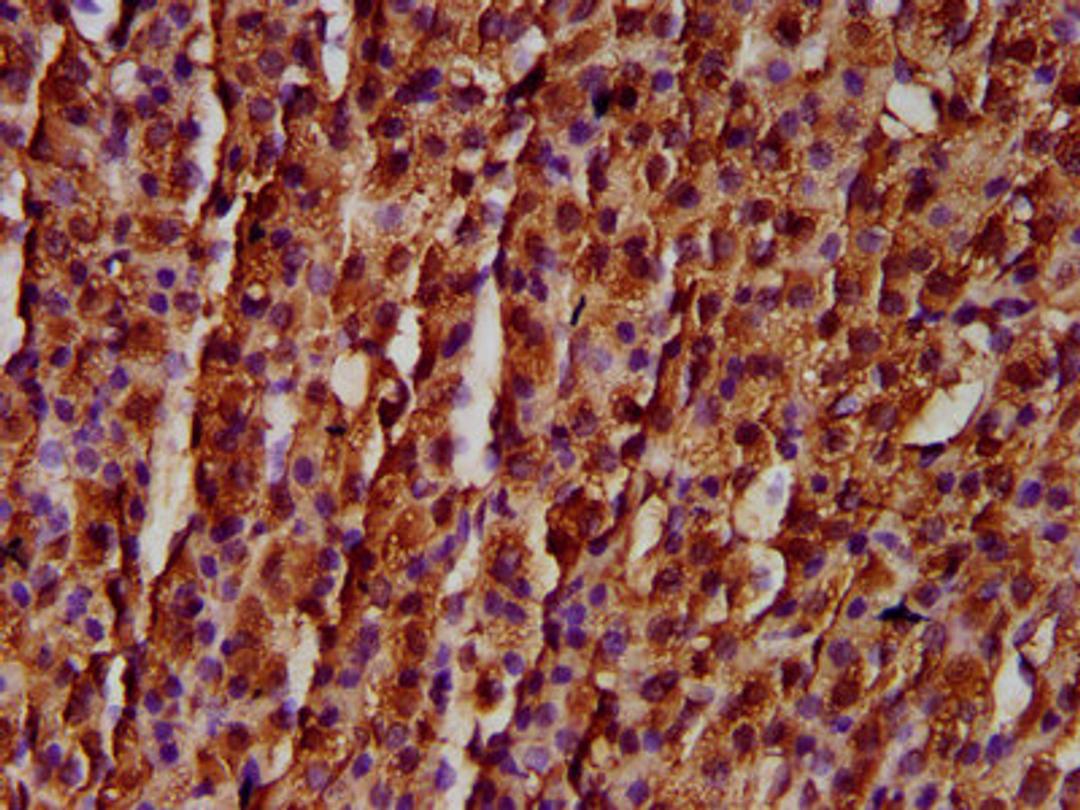 IHC image of CSB-PA801247LA01HU diluted at 1:300 and staining in paraffin-embedded human adrenal gland tissue performed on a Leica BondTM system. After dewaxing and hydration, antigen retrieval was mediated by high pressure in a citrate buffer (pH 6.0). Section was blocked with 10% normal goat serum 30min at RT. Then primary antibody (1% BSA) was incubated at 4&deg;C overnight. The primary is detected by a biotinylated secondary antibody and visualized using an HRP conjugated SP system.