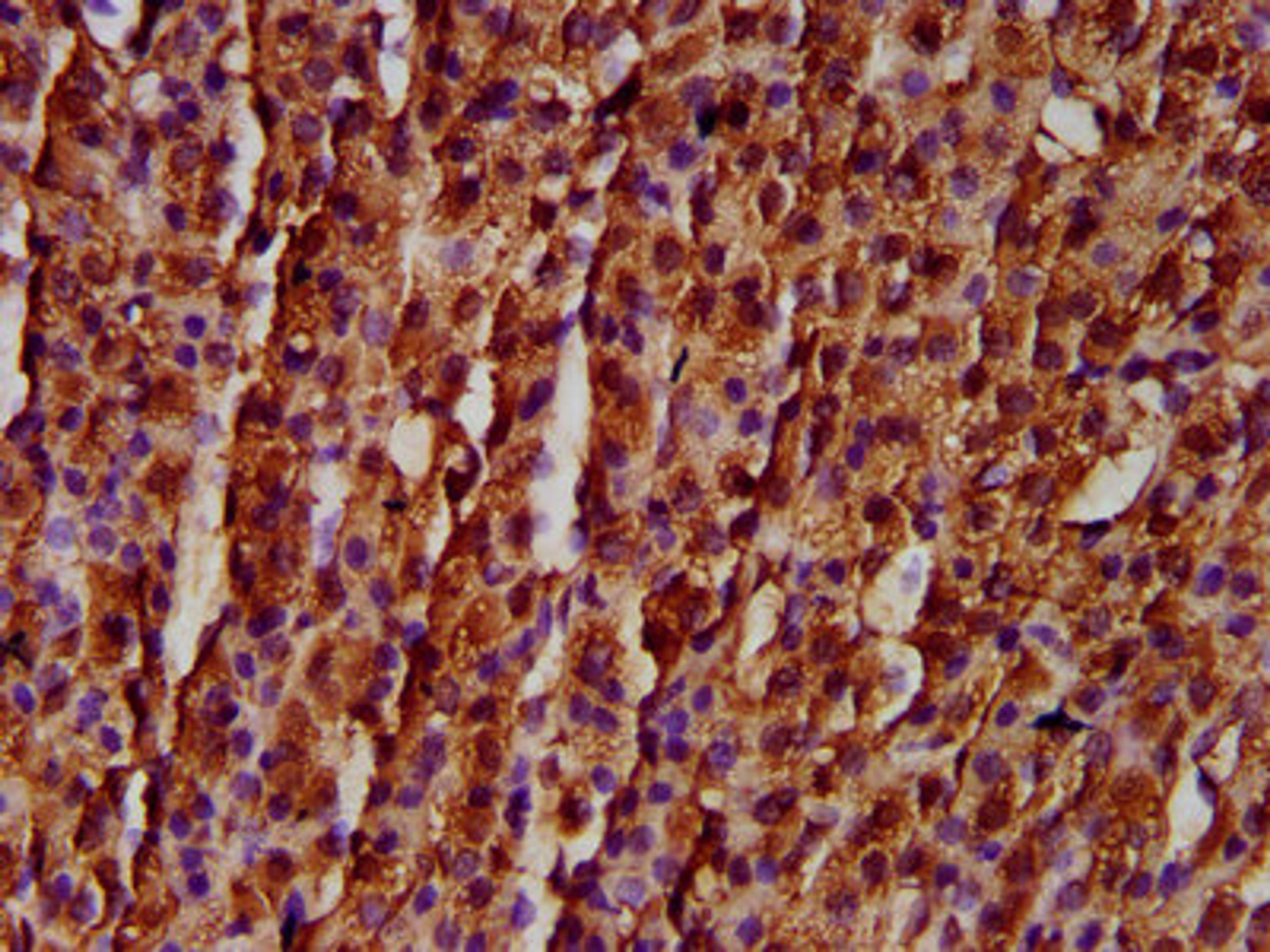 IHC image of CSB-PA801247LA01HU diluted at 1:300 and staining in paraffin-embedded human adrenal gland tissue performed on a Leica BondTM system. After dewaxing and hydration, antigen retrieval was mediated by high pressure in a citrate buffer (pH 6.0). Section was blocked with 10% normal goat serum 30min at RT. Then primary antibody (1% BSA) was incubated at 4&deg;C overnight. The primary is detected by a biotinylated secondary antibody and visualized using an HRP conjugated SP system.