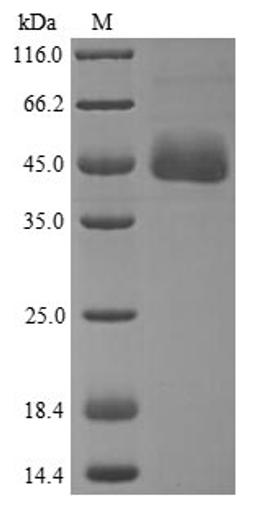 (Tris-Glycine gel) Discontinuous SDS-PAGE (reduced) with 5% enrichment gel and 15% separation gel.